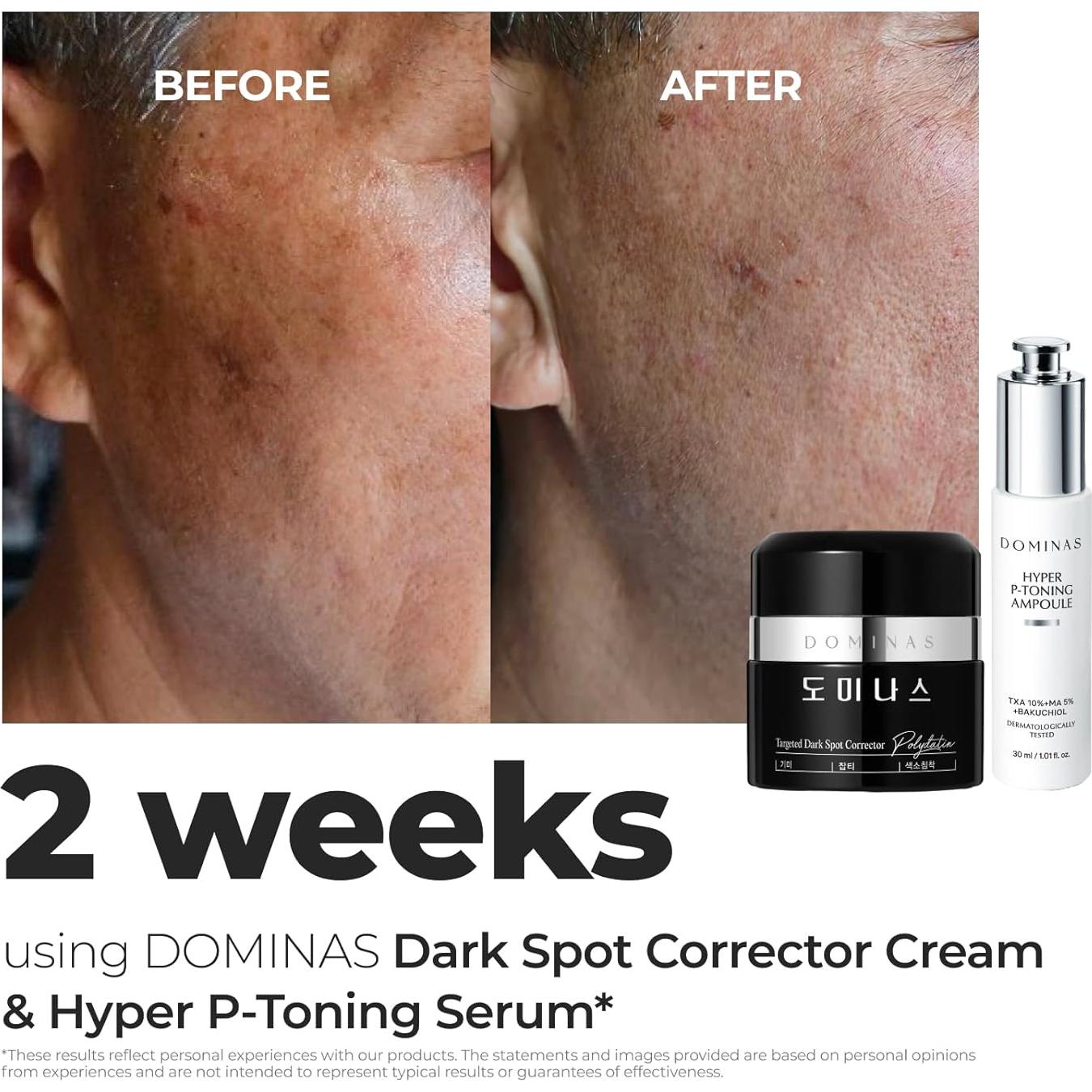 Crema Correctora de Manchas Oscuras DOMINAS 50g - Niacinamida