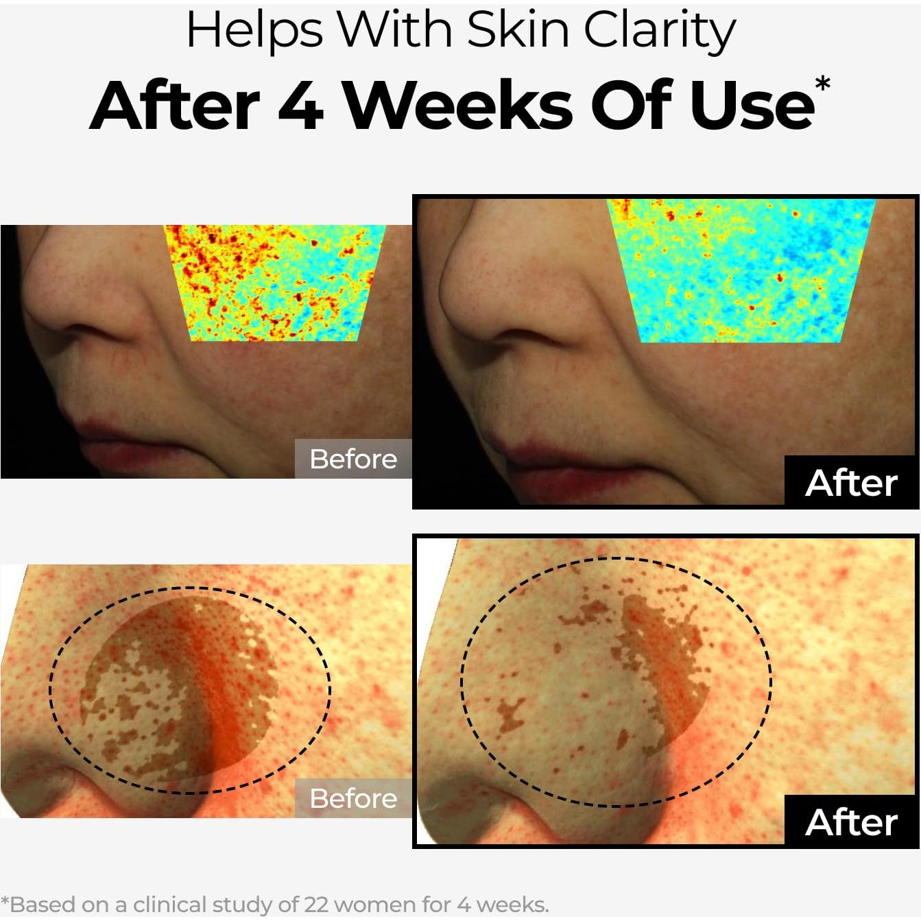 Crema Correctora de Manchas Oscuras DOMINAS 50g - Niacinamida