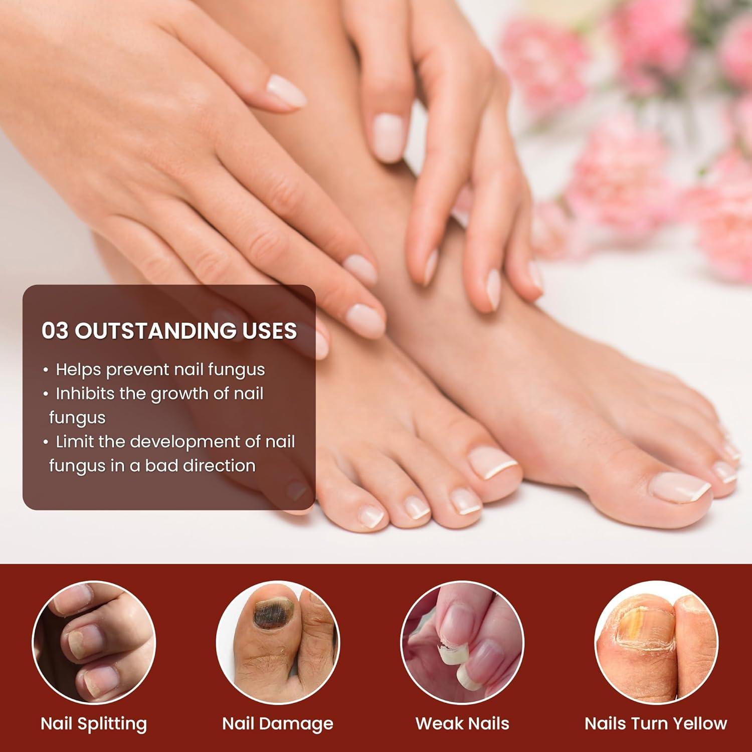 Suero Reparador de Uñas Abera - Cuidado Intensivo Rojo