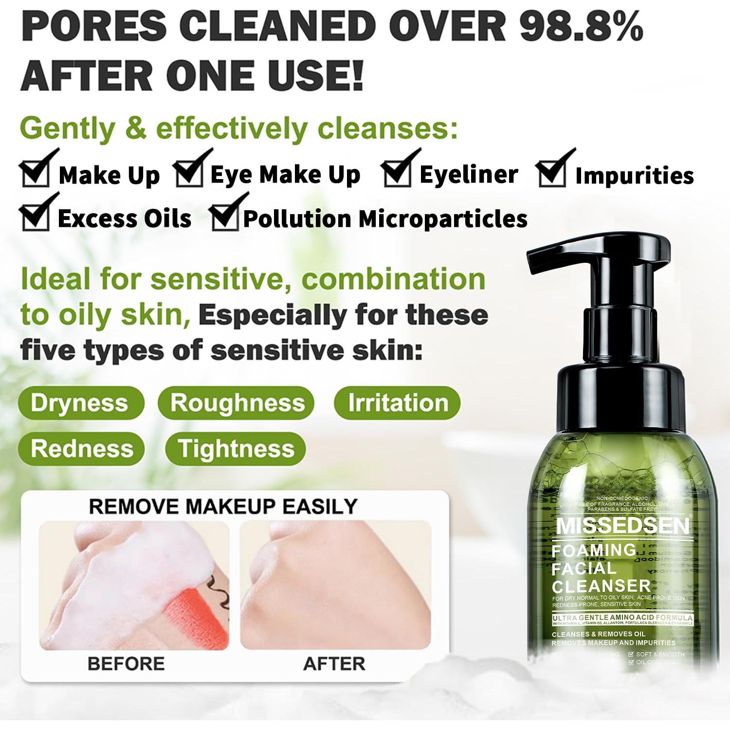 Limpiador Facial Espumoso Missedsen 284 g Piel Grasa Acné