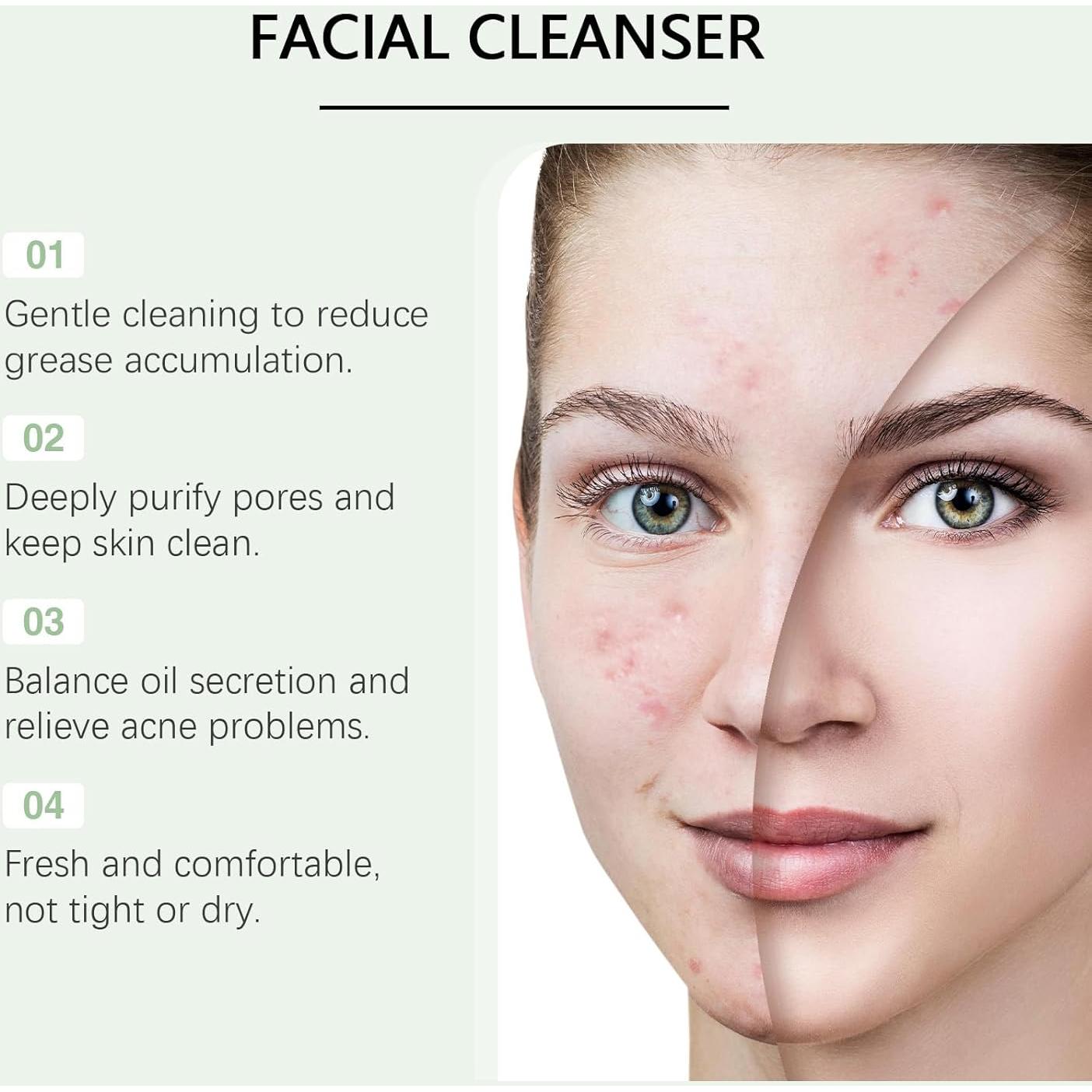 Limpiador Facial Control de Aceite Shantou 100 g - Ácido Azelaico y Salicílico