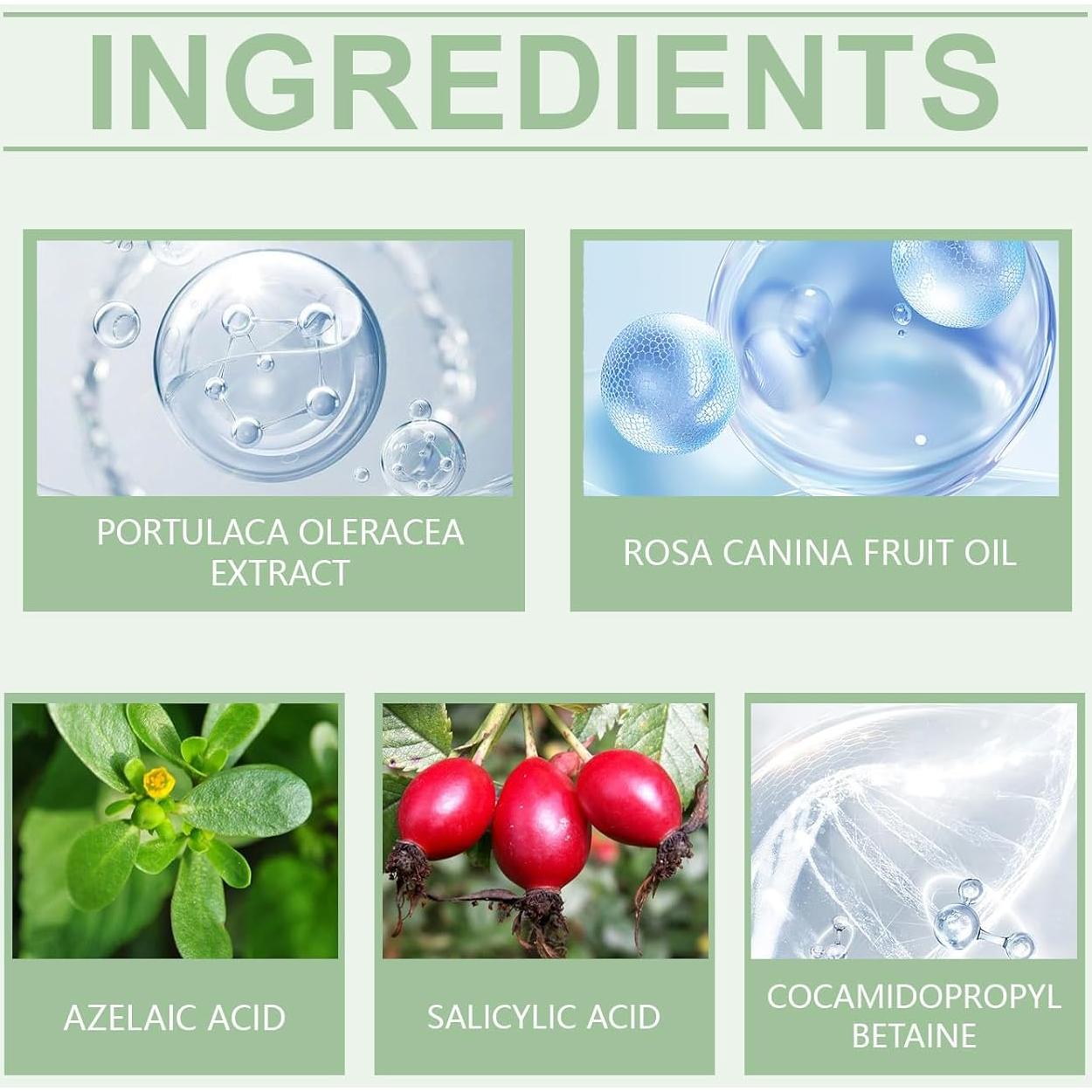 Limpiador Facial Control de Aceite Shantou 100 g - Ácido Azelaico y Salicílico