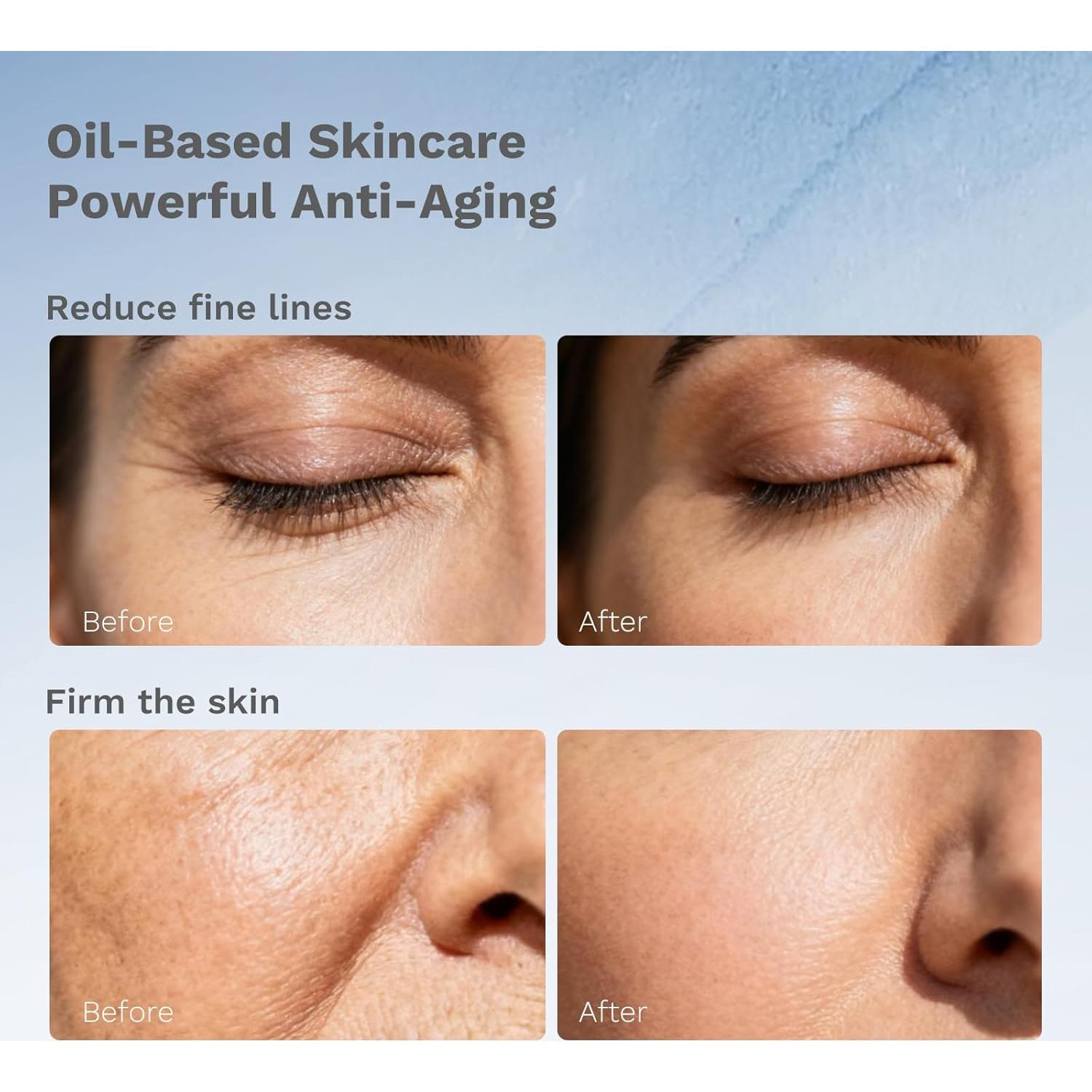 Cápsulas APoEM Renew 60 CT - Suero Antienvejecimiento Aceite