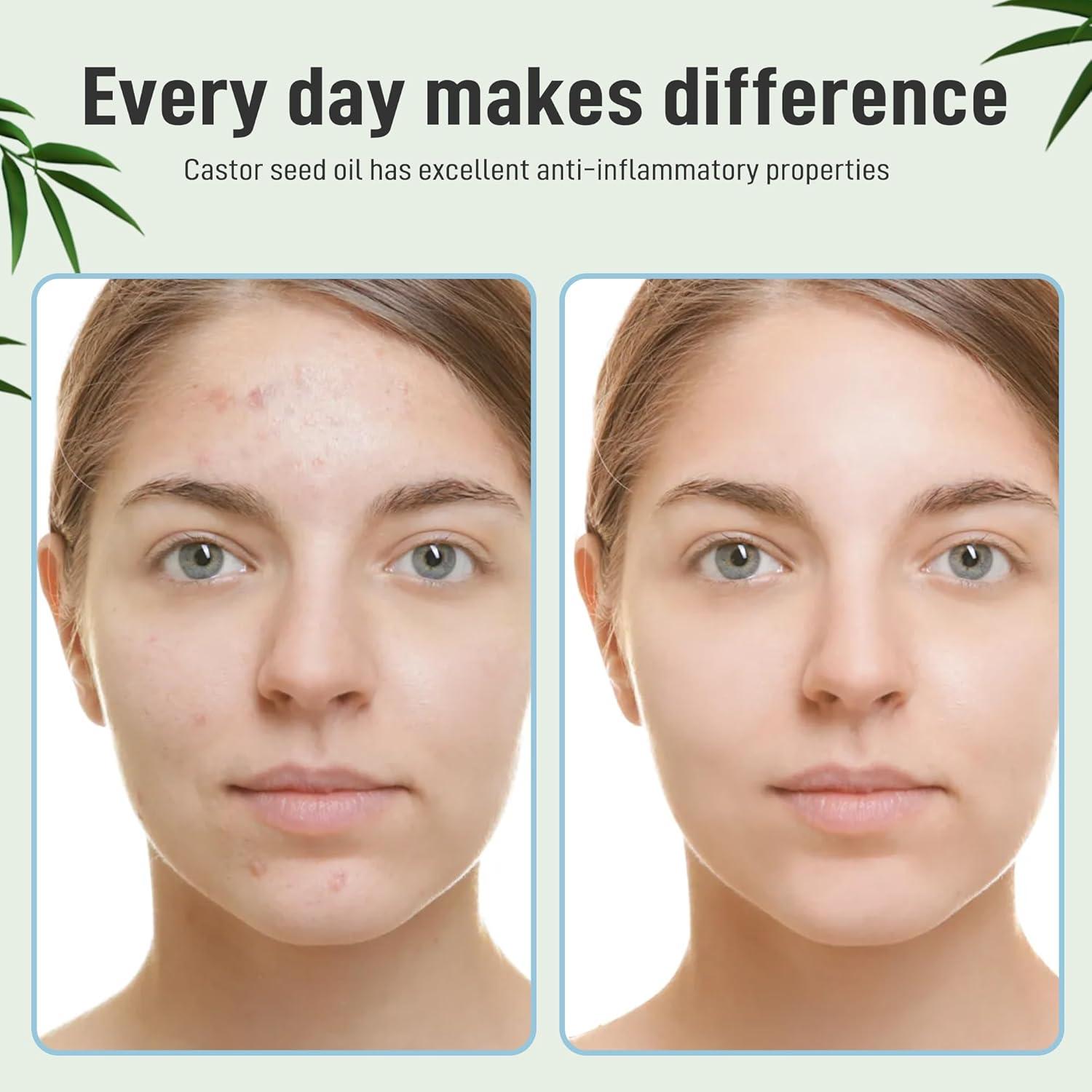 Funda de Aceite de Ricino Leekalos Orgánica Reutilizable 24x14cm