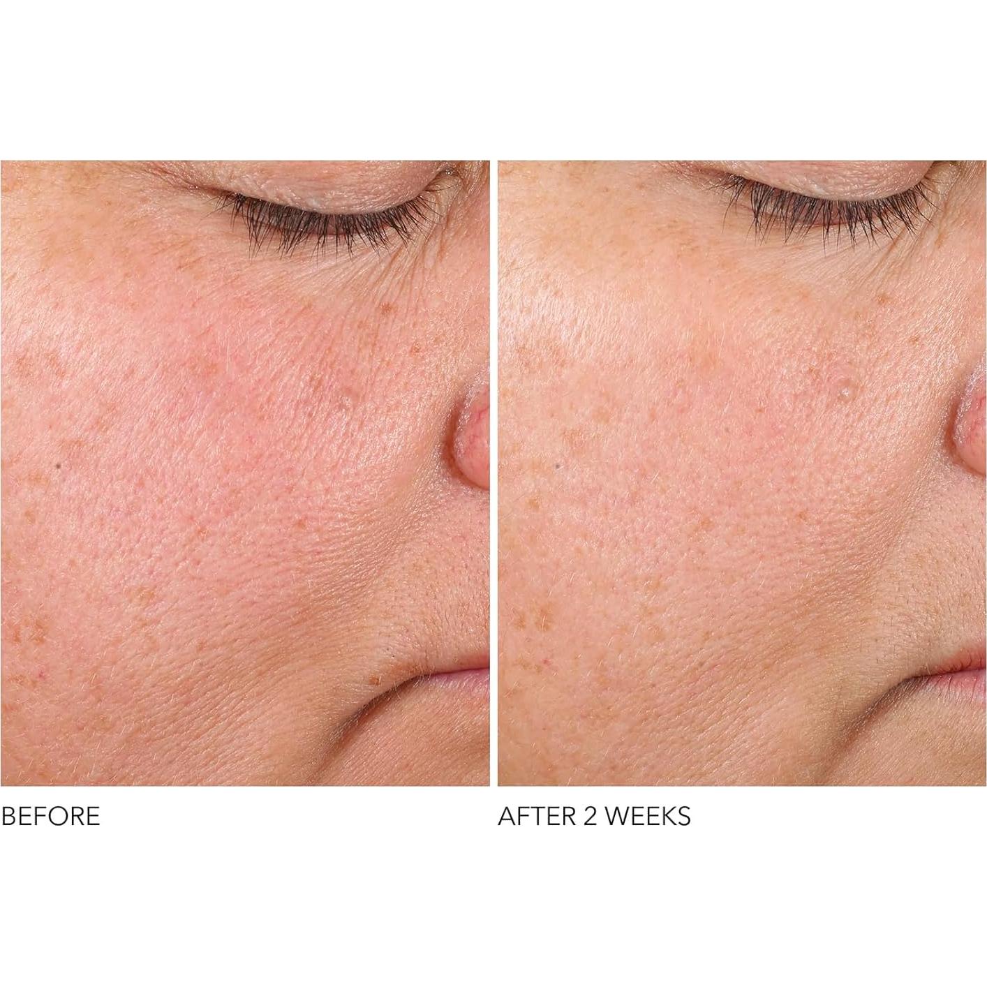 Suero Antienvejecimiento Dr. Dennis Gross con Retinol 28.35 g