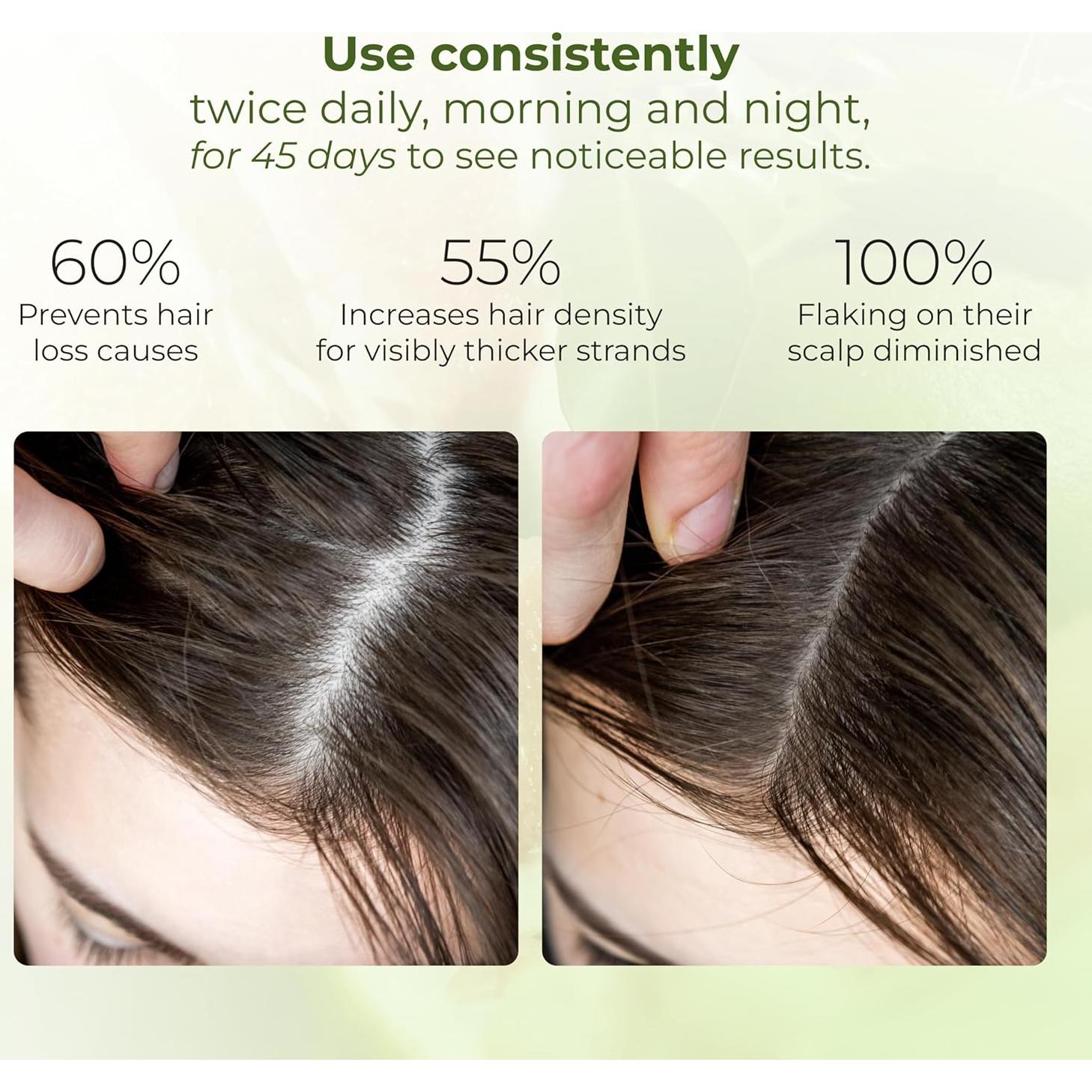 Tónico Capilar Cocoon 140 ml - Suero Vegano para Crecimiento Cabello