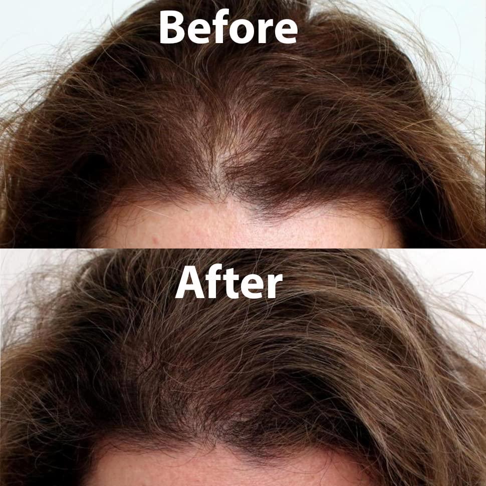 Tónico Capilar Cocoon 140 ml - Suero Vegano para Crecimiento Cabello