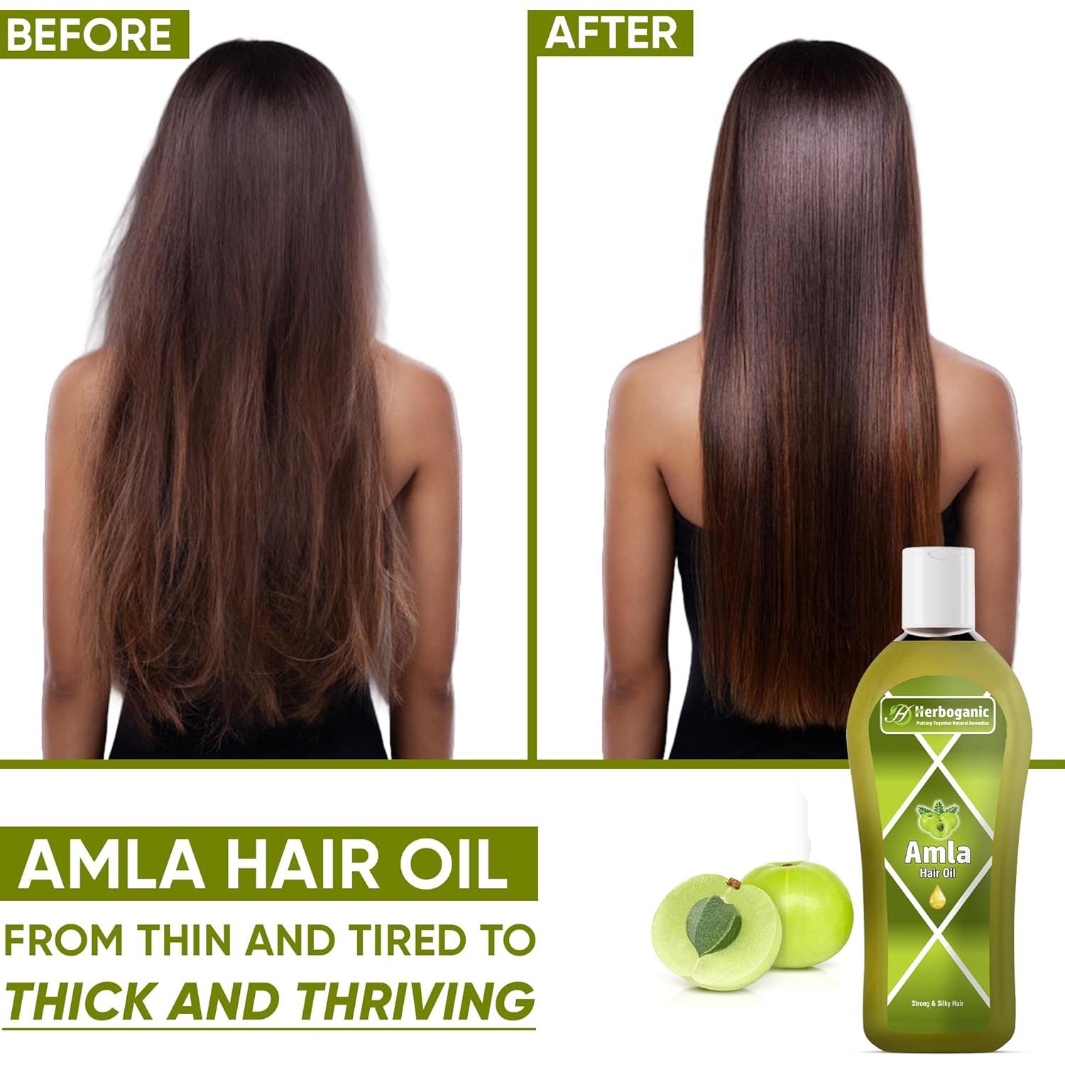 Aceite Herbal de Amla Herboganic 148 ml - Crecimiento Cabello