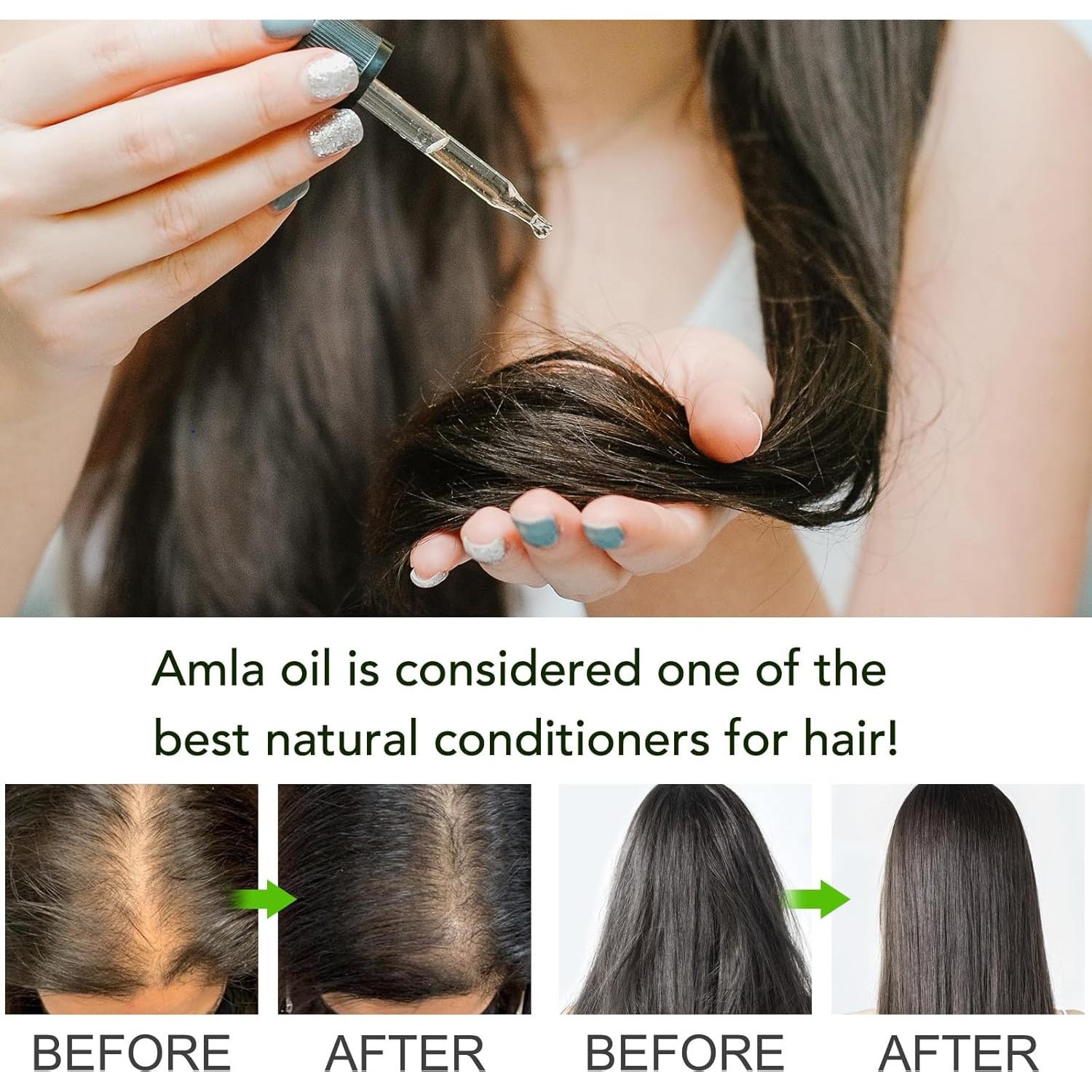 Aceite de Amla 100% Puro Orgánico 60ml - Crecimiento y Hidratación