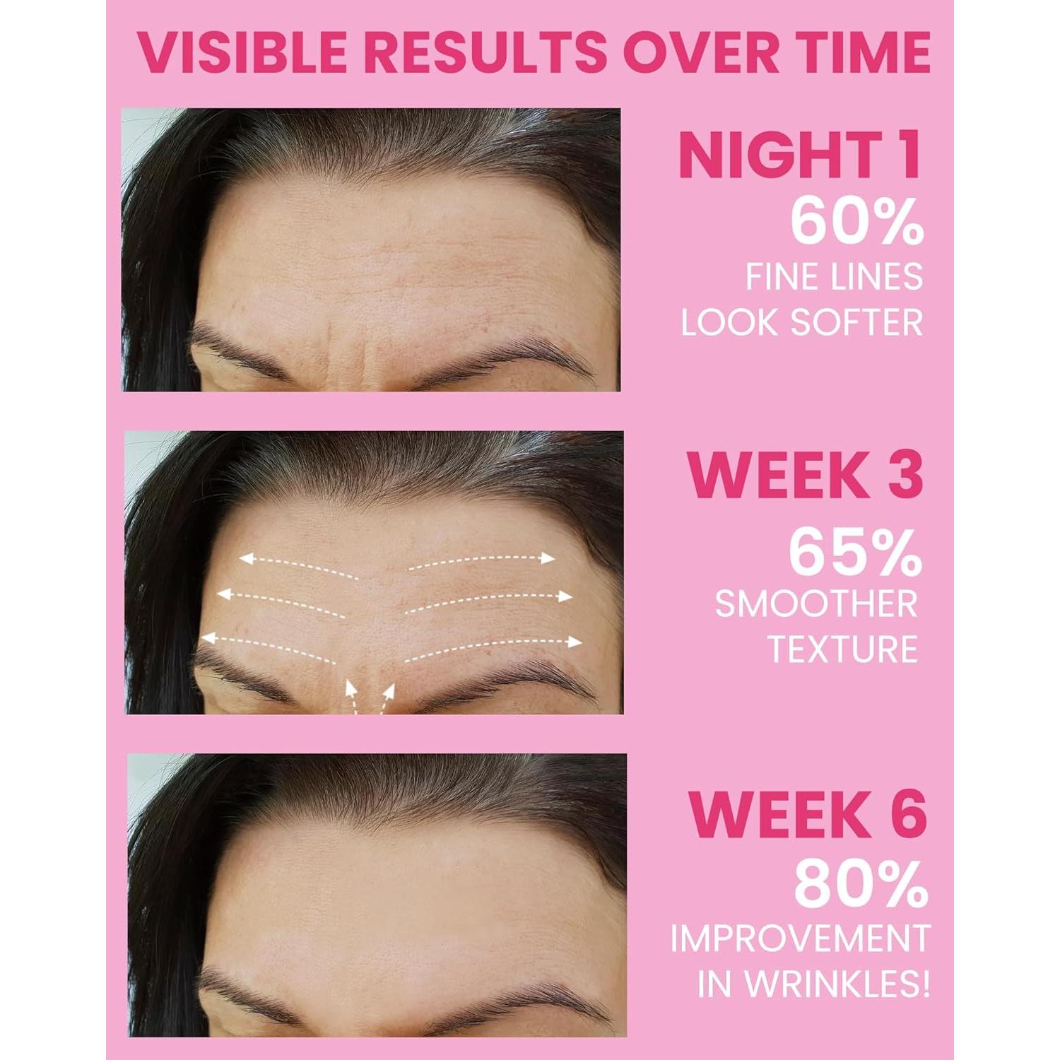 Parches Faciales Antiarrugas Akissos 80PCS - Cuidado Nocturno