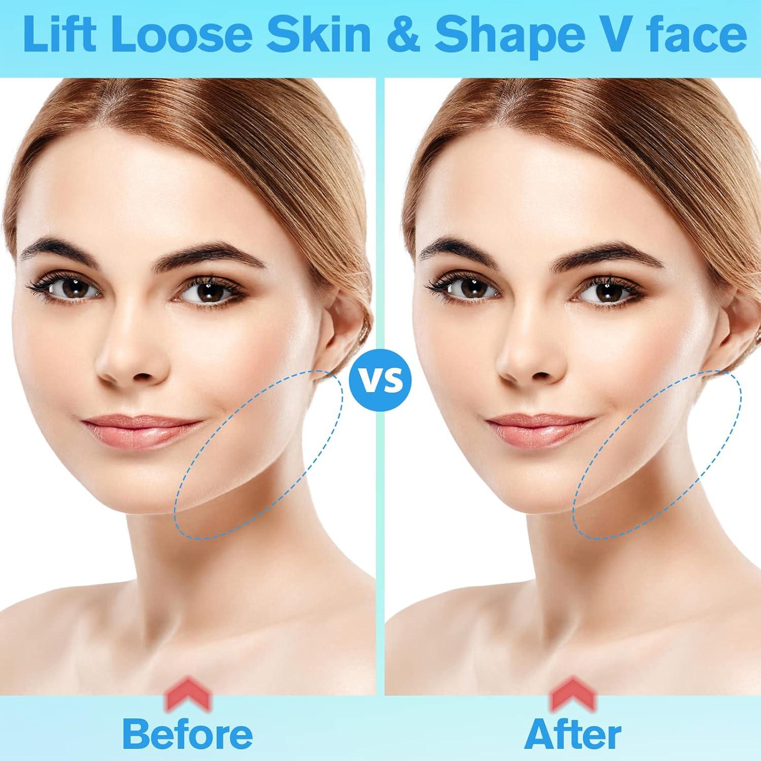 Cinta Levantadora Facial Invisible Netlkjonk - 156 Piezas