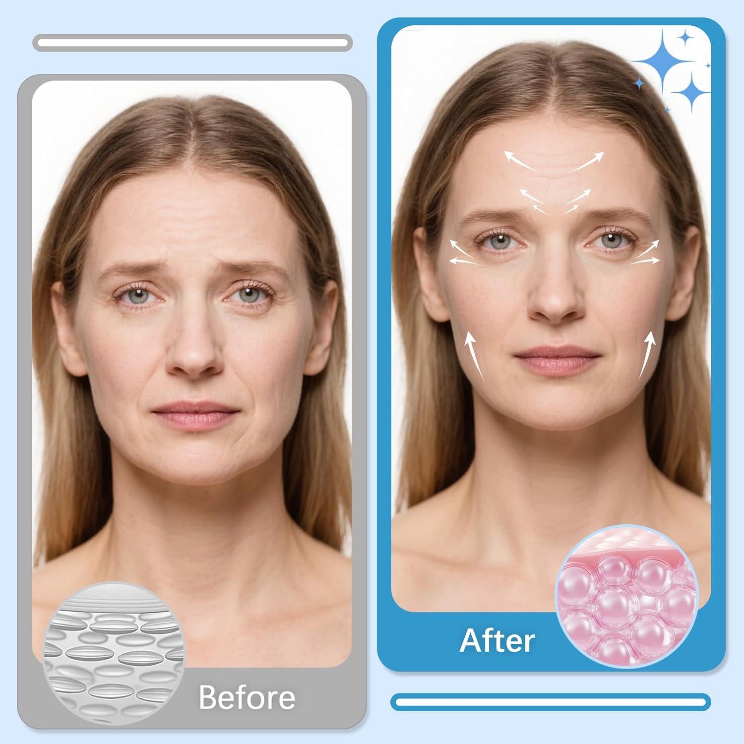 Parches Antienvejecimiento LadPemo - 208 Pcs para Arrugas Faciales