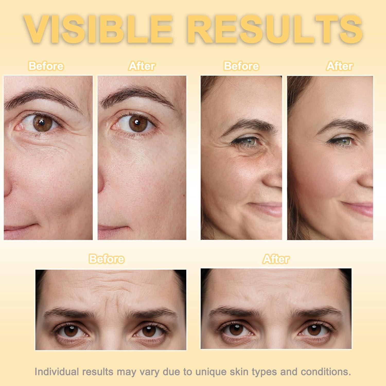 Cinta Facial Antienvejecimiento Rosa - Elevación y Arrugas