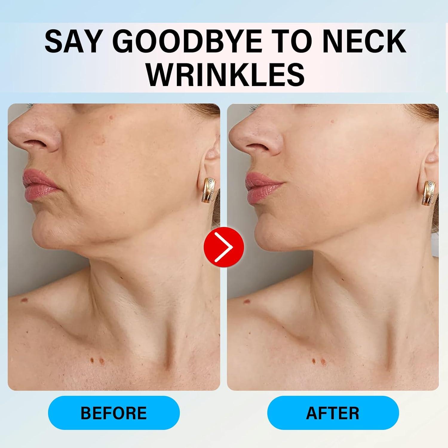 Cinta Elevadora para Cuello GoetGeas - 20 Parches Reutilizables