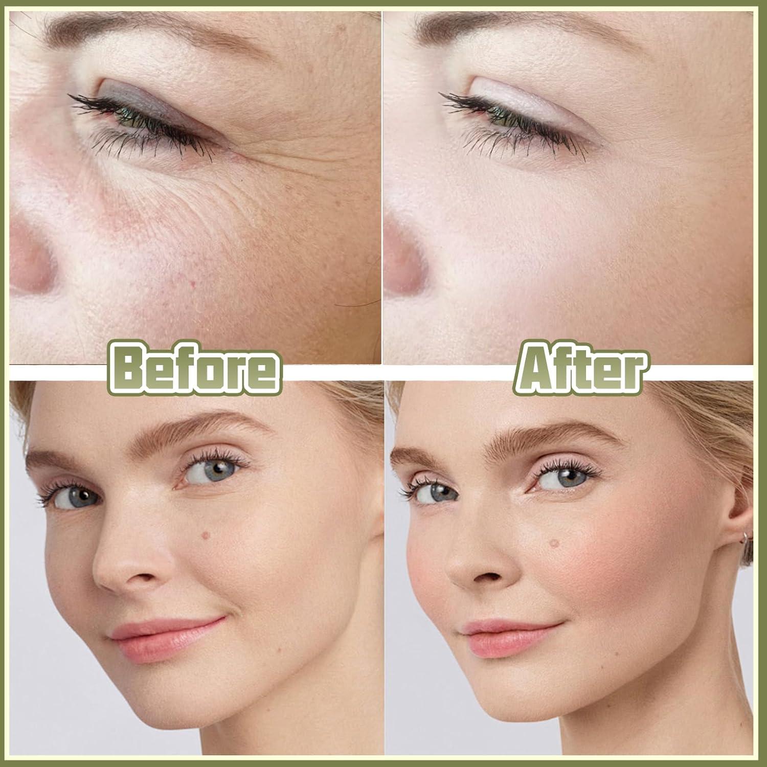 Cinta Levantadora Facial Invisible 240 Piezas - Guangzhou Hailuopu