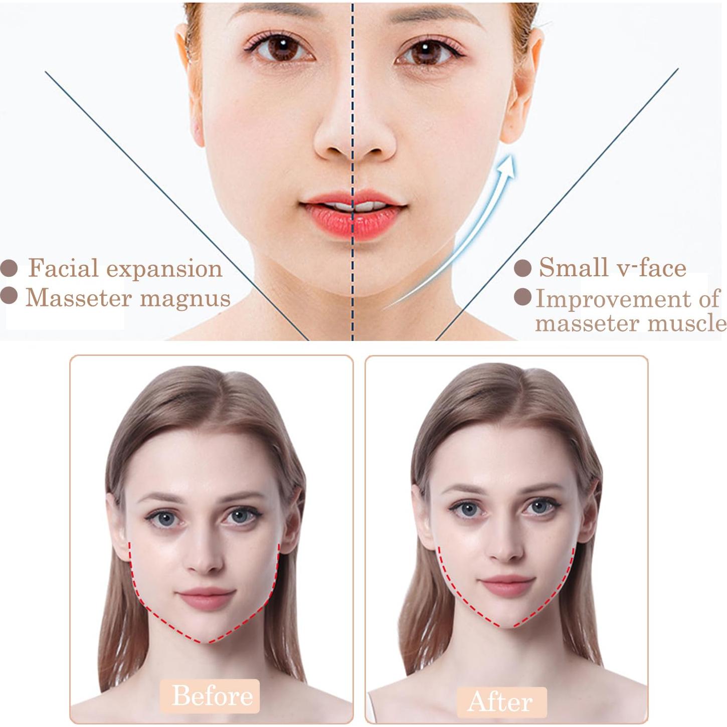 Cinta de Levantamiento Facial Invisible Aaiffey 188 Pzs