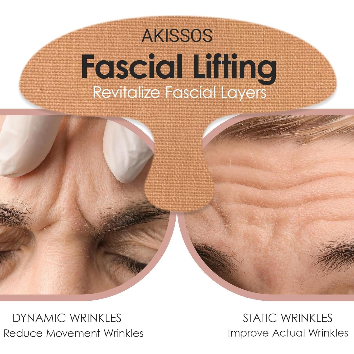 Parches Faciales Antiarrugas Akissos - 15 Piezas Hipoalergénicas