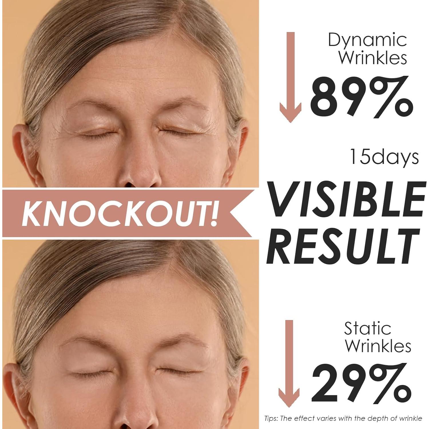 Parches Faciales Antiarrugas Akissos - 15 Piezas Hipoalergénicas