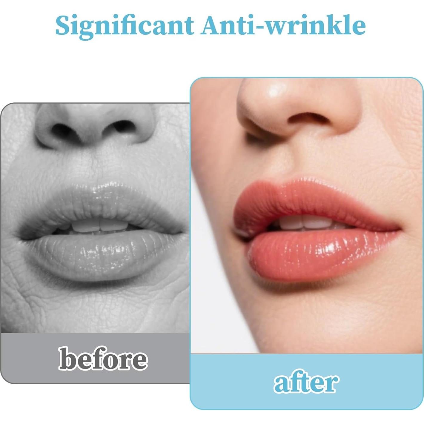 Parche Antienvejecimiento Labial YUAN-WANG 6 Piezas Hidratante