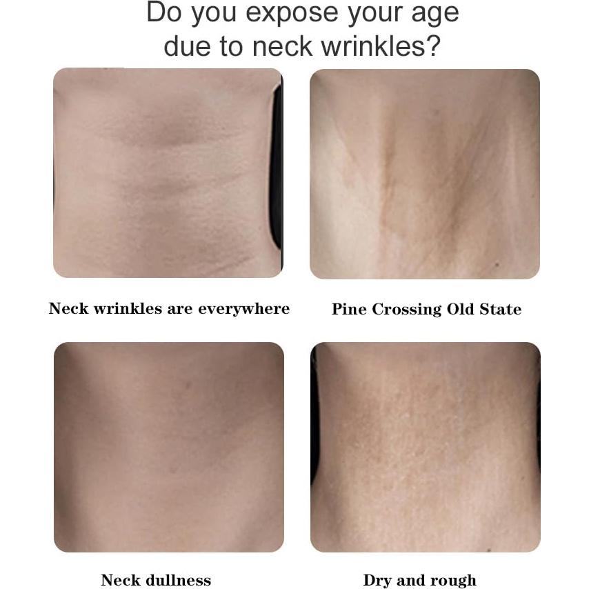 Cinta Elevadora de Cuello Invisible Sunnydeer - 8 Tiras + 40 Parches