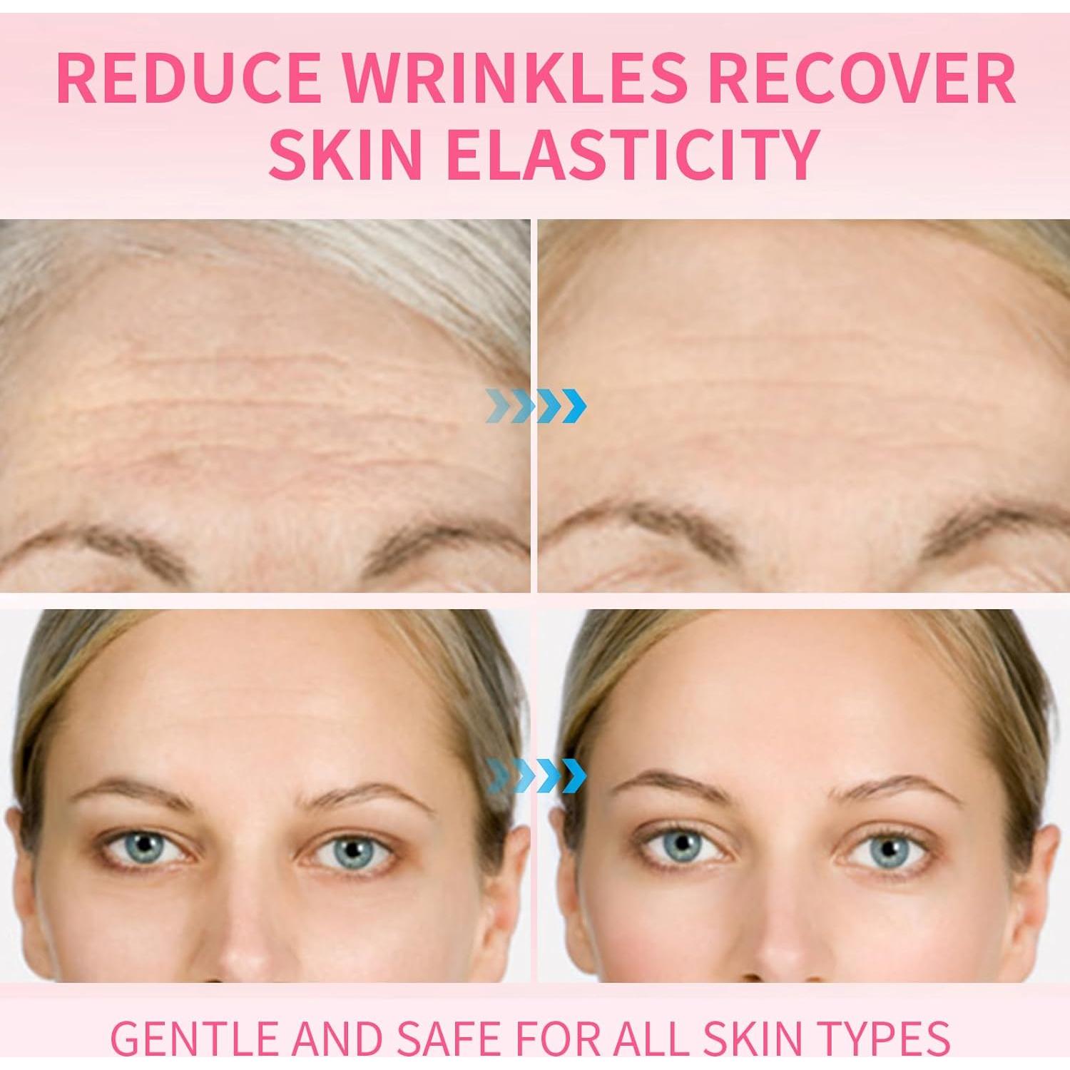 Set de 16 Parches Antiarrugas Faciales CGPVTSJ - Reutilizables