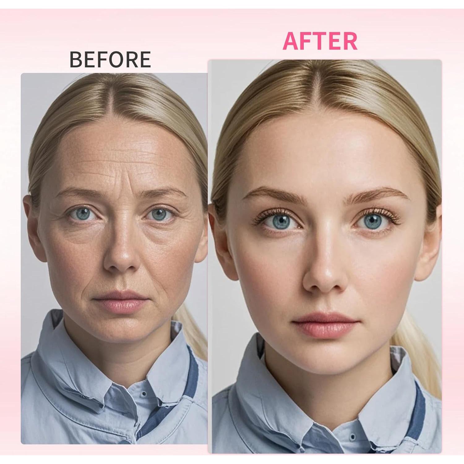 Set de 16 Parches Antiarrugas Faciales CGPVTSJ - Reutilizables