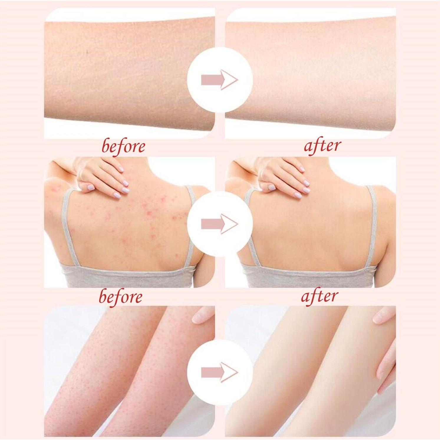 Bola de Baño Exfoliante 2 en 1 ZQtyf con Ventosa Amarilla