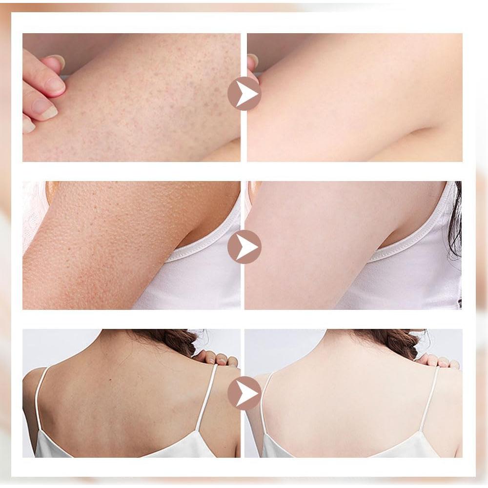 Bola de Baño Exfoliante Suave Cecurpo con Ventosa Colorida