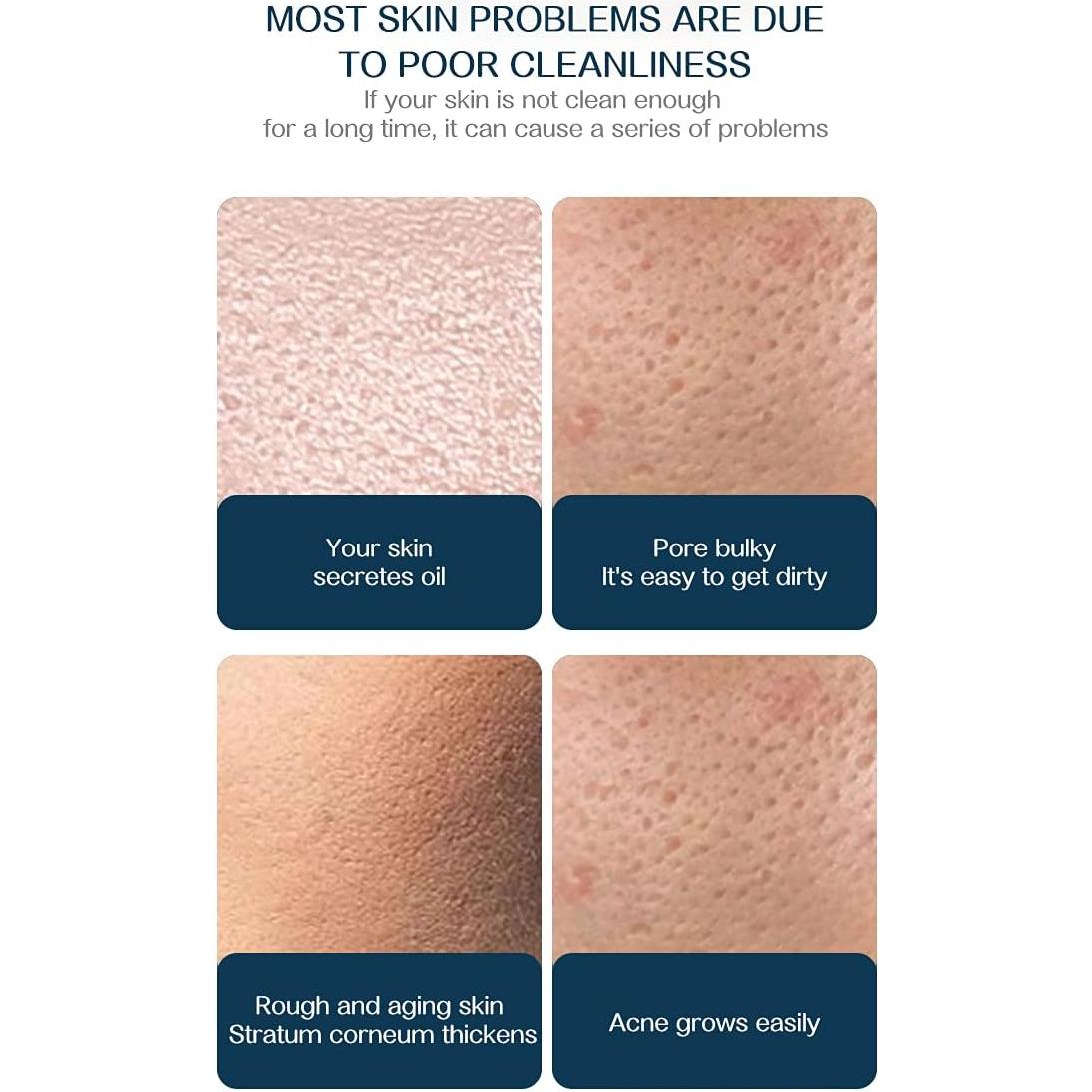 Cepillo Facial Limpiador Suaviskin MZ-1079 USB Exfoliante