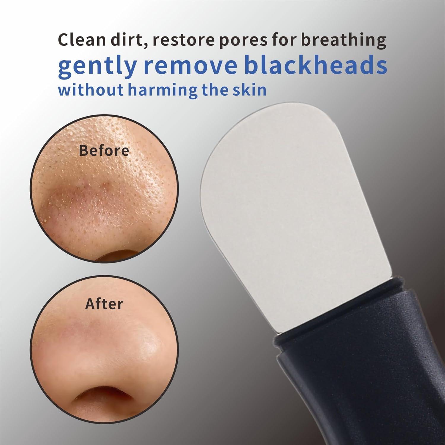 Limpiador Facial Multifuncional YUSAGO 2 en 1 Negro