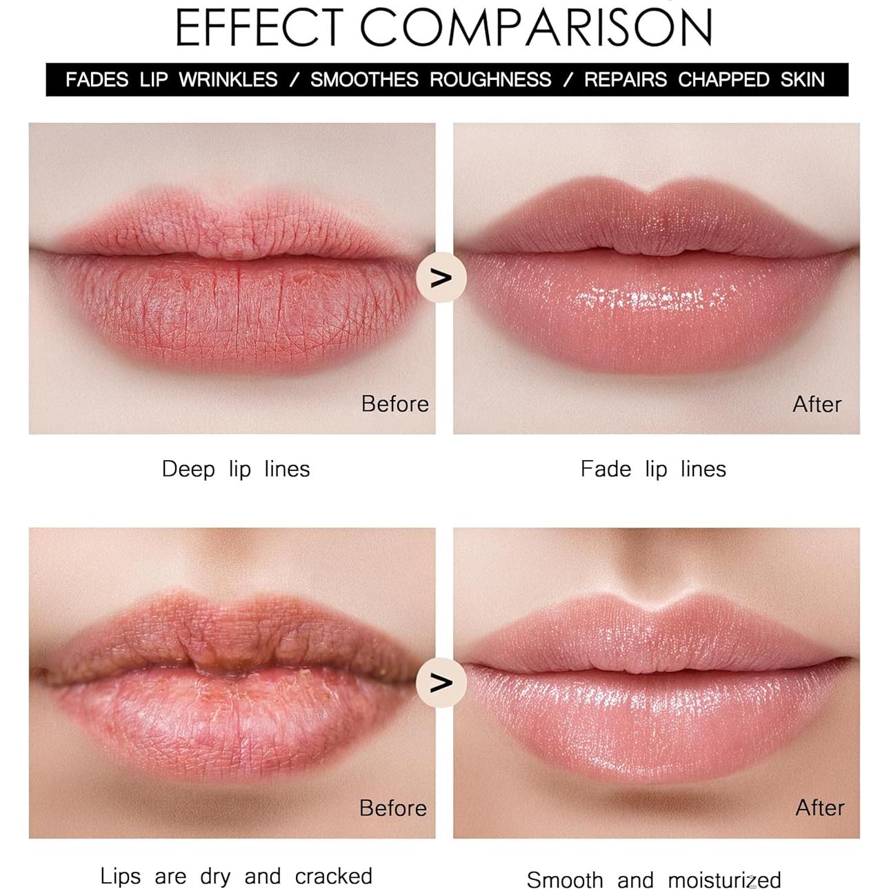 Rodillo Derma TIDEWISH con Aplicador de Suero 0.25mm Rosa