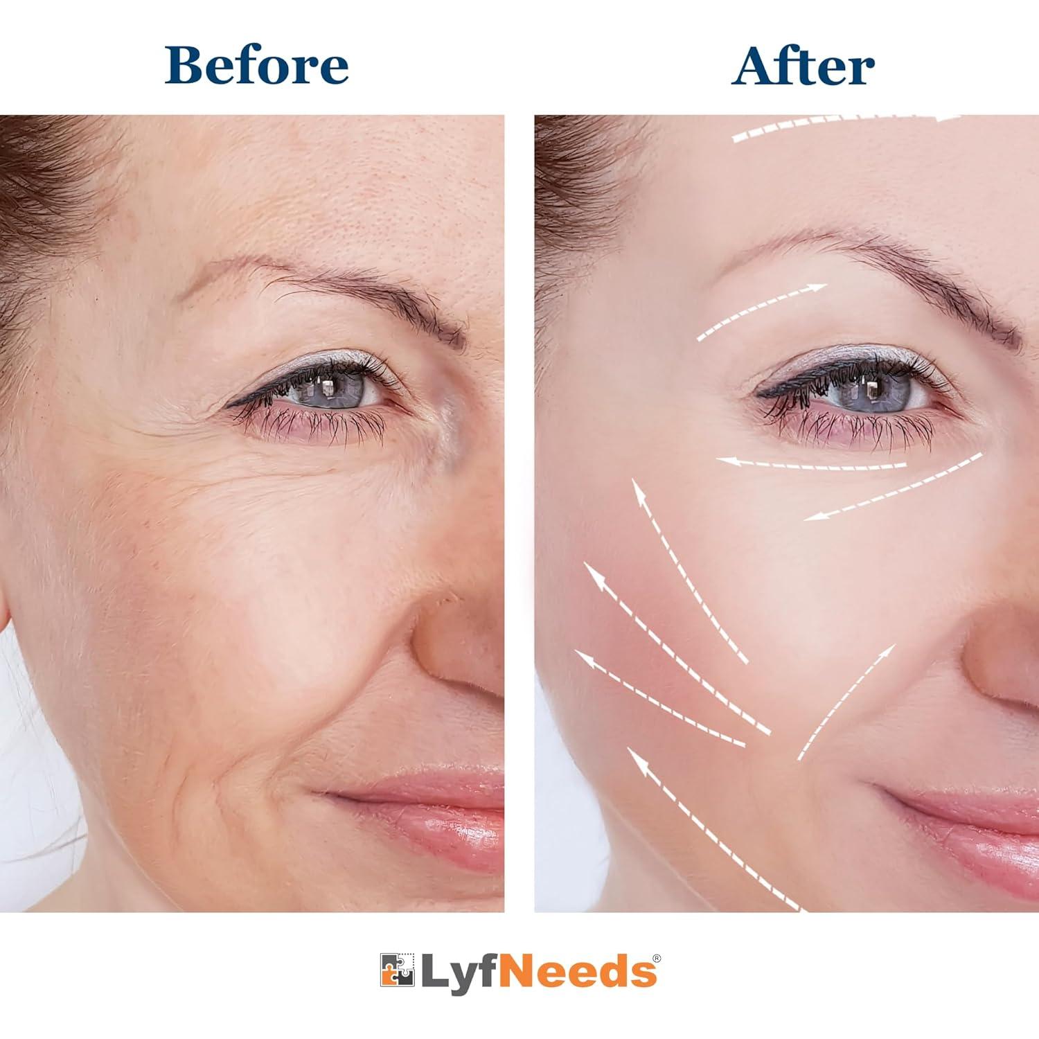 Rodillo de Hielo para Cara LyfNeeds - Silicona Reutilizable 10cm