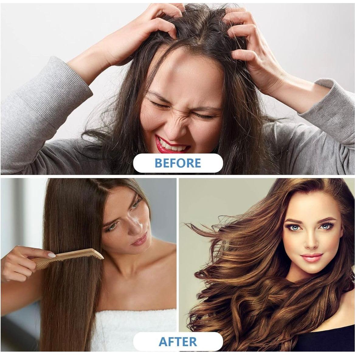 Gorros de Champú Sin Enjuague LineMedCare - 3 Paquetes