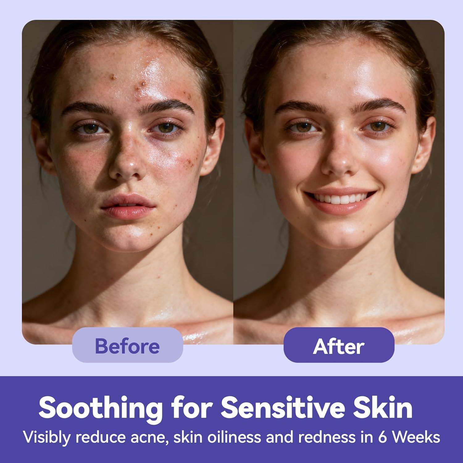 Toallas Faciales Desechables Jolly Care 19.8 cm 80 Unidades