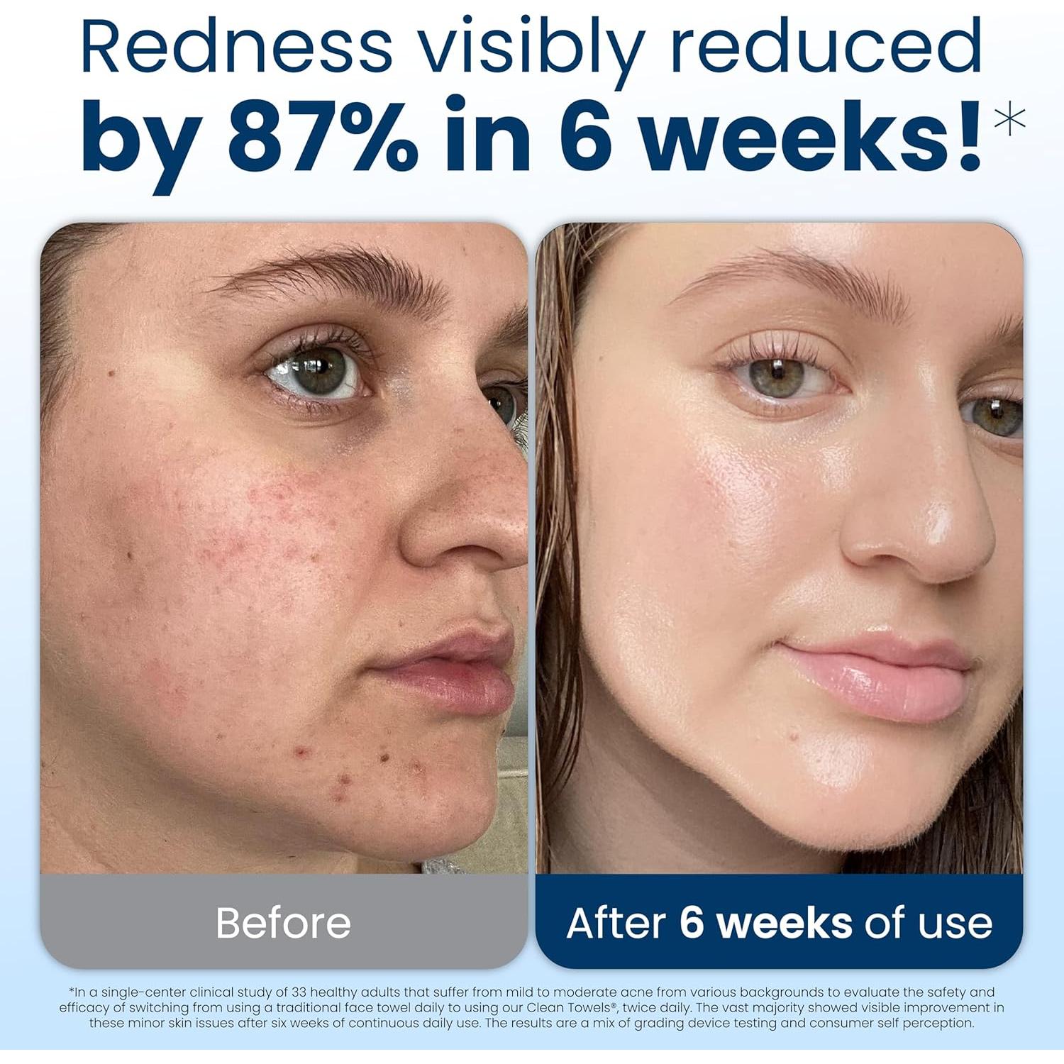 Toallas Limpias Club Toallas XL 100% Biobasadas - 30 Unidades