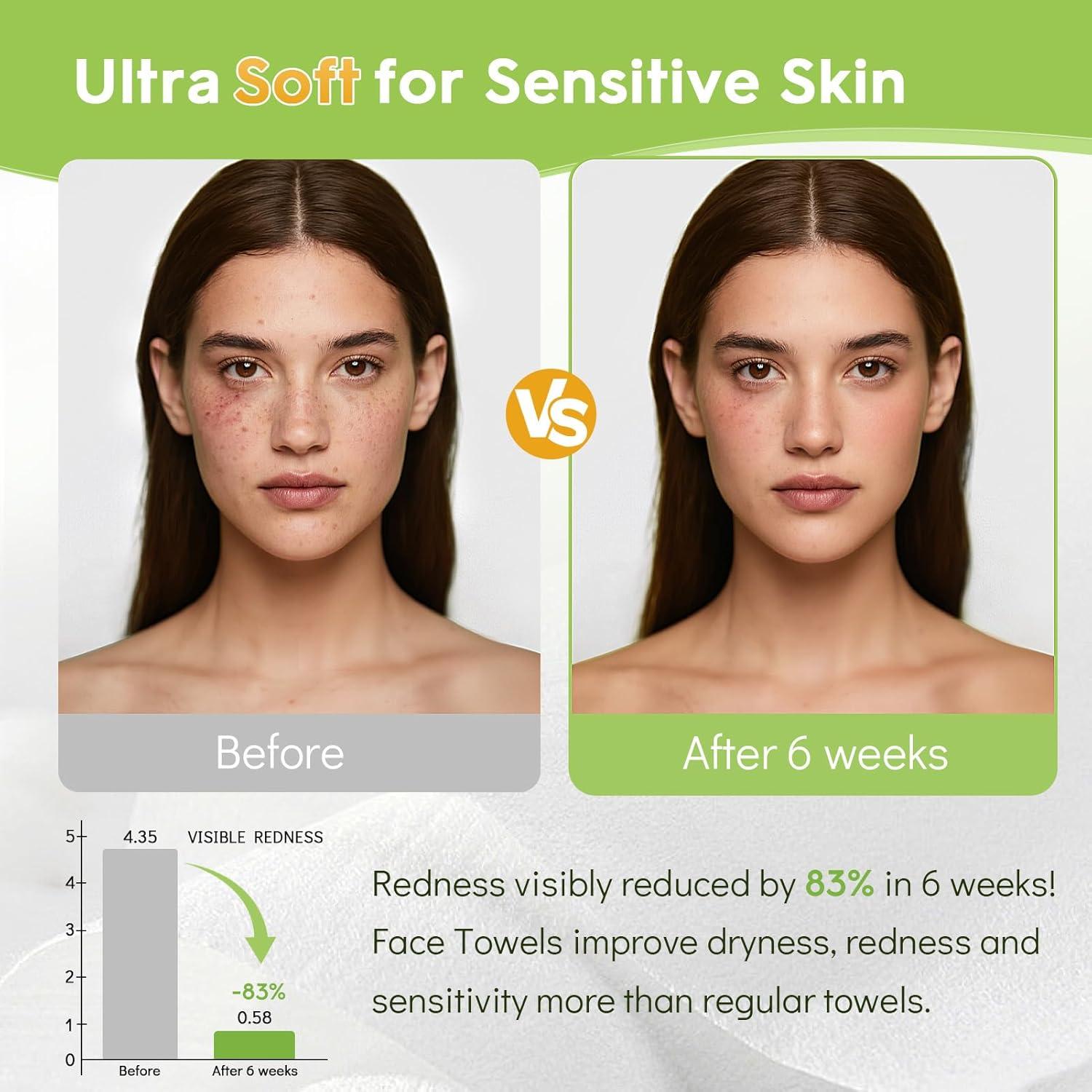 Toallas Faciales Desechables Classycoo XL 100% Algodón Suave 50 Unidades