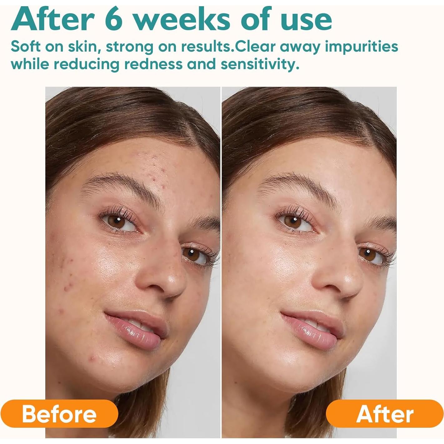 Toallas Faciales Desechables UNIMADE - 200 Unidades Ultra Suaves