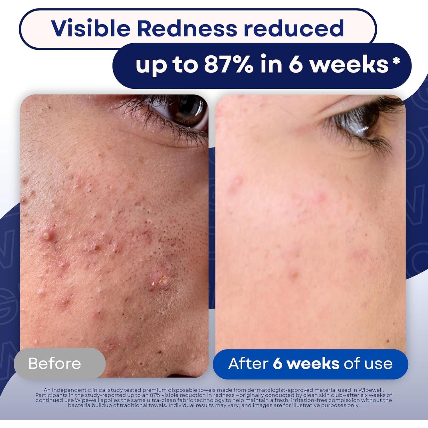 Toallas Faciales Desechables WipeWell 50 Unidades Ultra Suaves