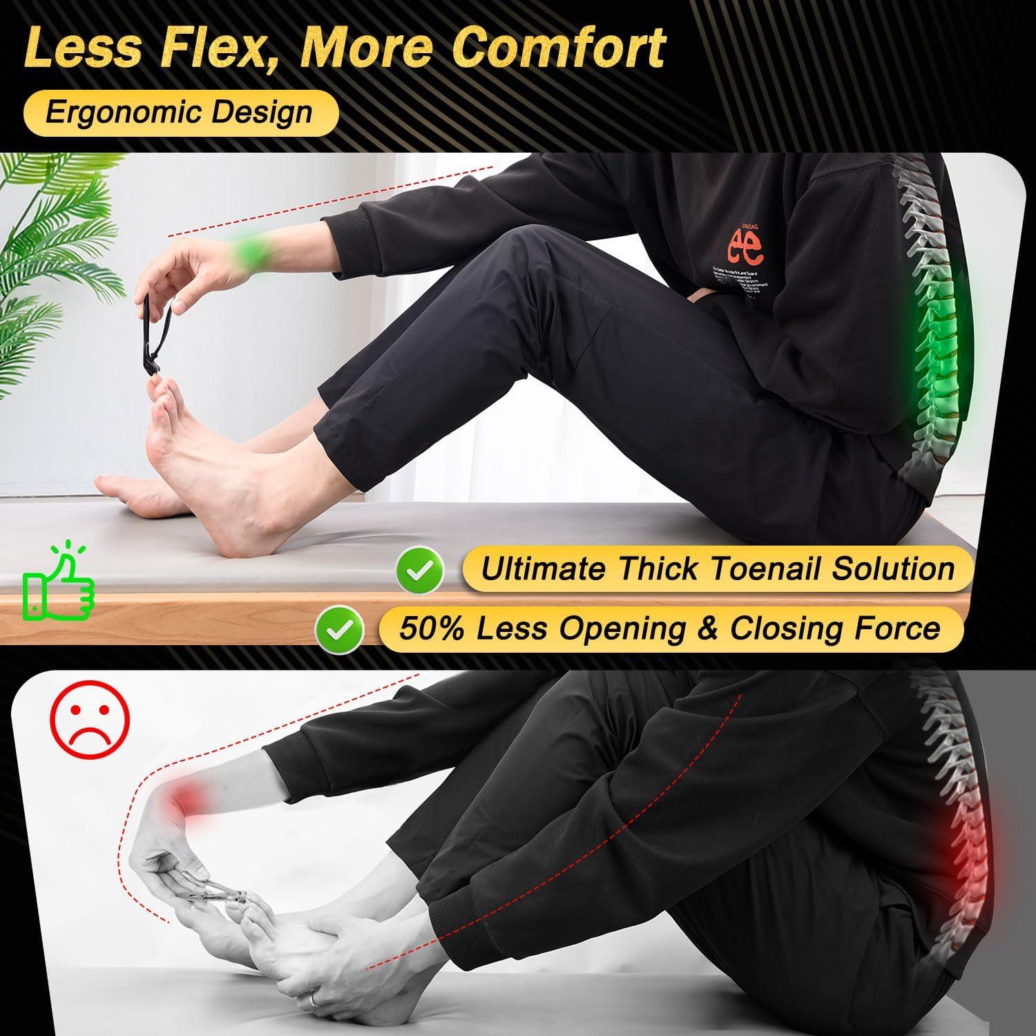 Cortauñas Trimlyx para Uñas Gruesas y Encarnadas 5Pcs