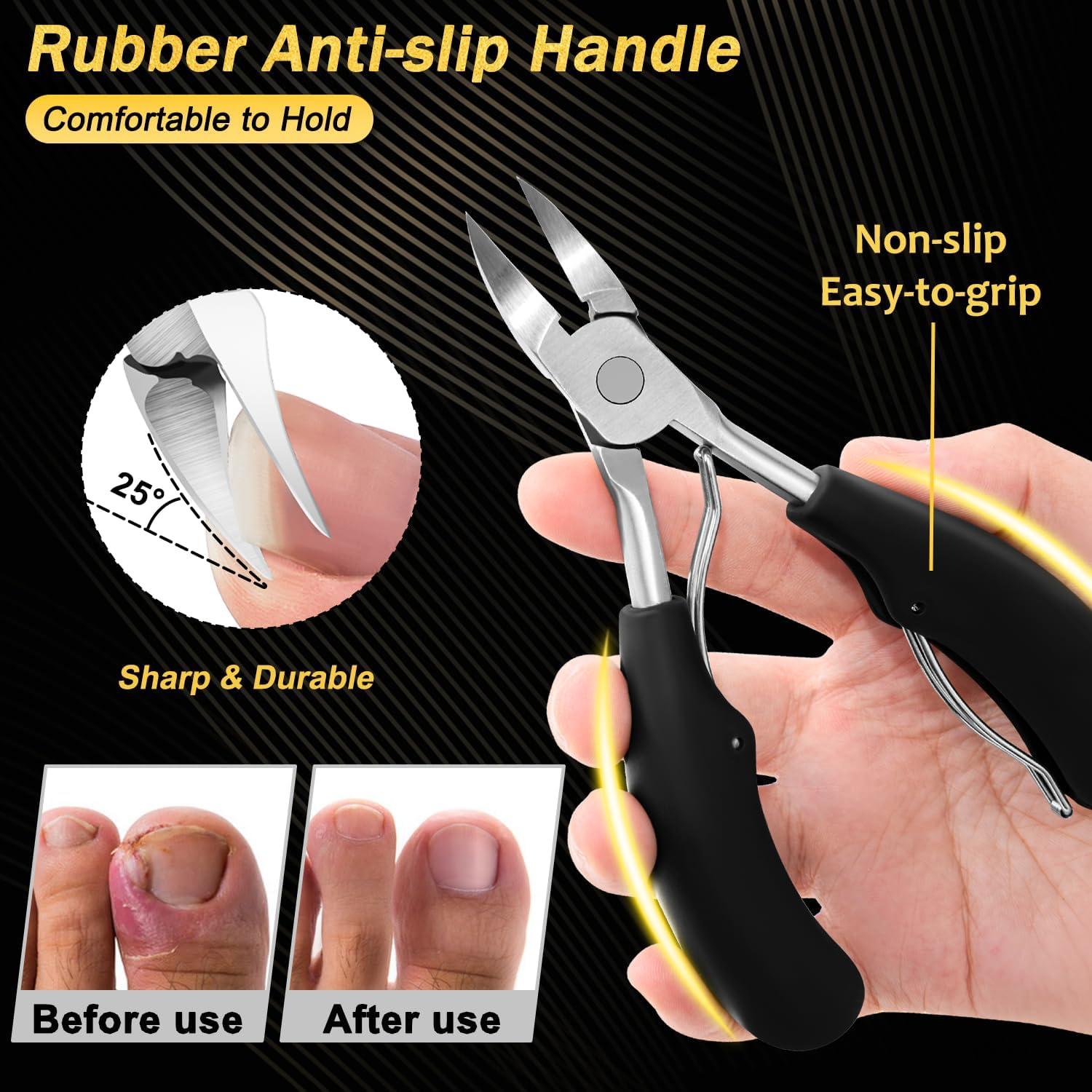 Cortauñas Trimlyx para Uñas Gruesas y Encarnadas 5Pcs