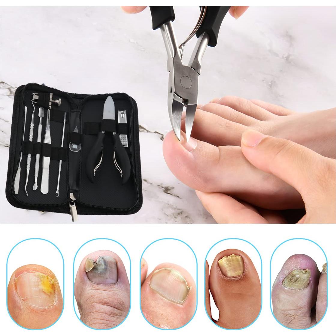 Juego de herramientas para uñas encarnadas Bcabo 10 piezas