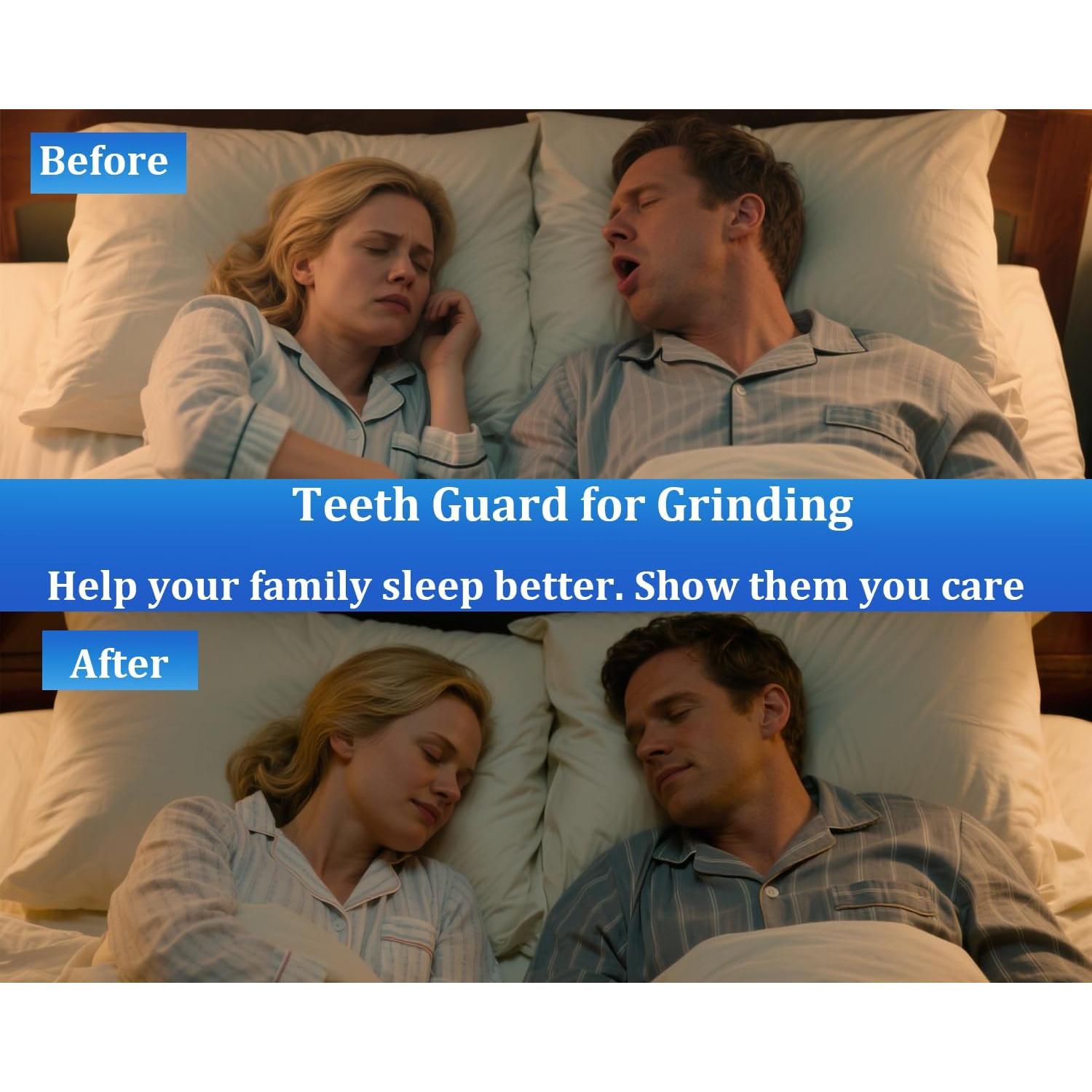 Protector Bucal Moldable HQCC para Rechinar Dientes - 4 Piezas