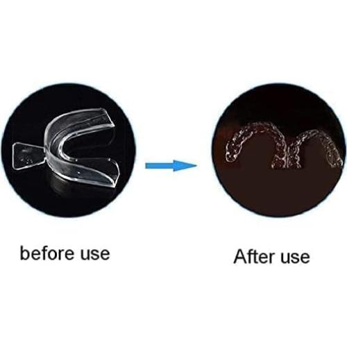 Set de 4 Protectores Bucales Transparentes Jinshining