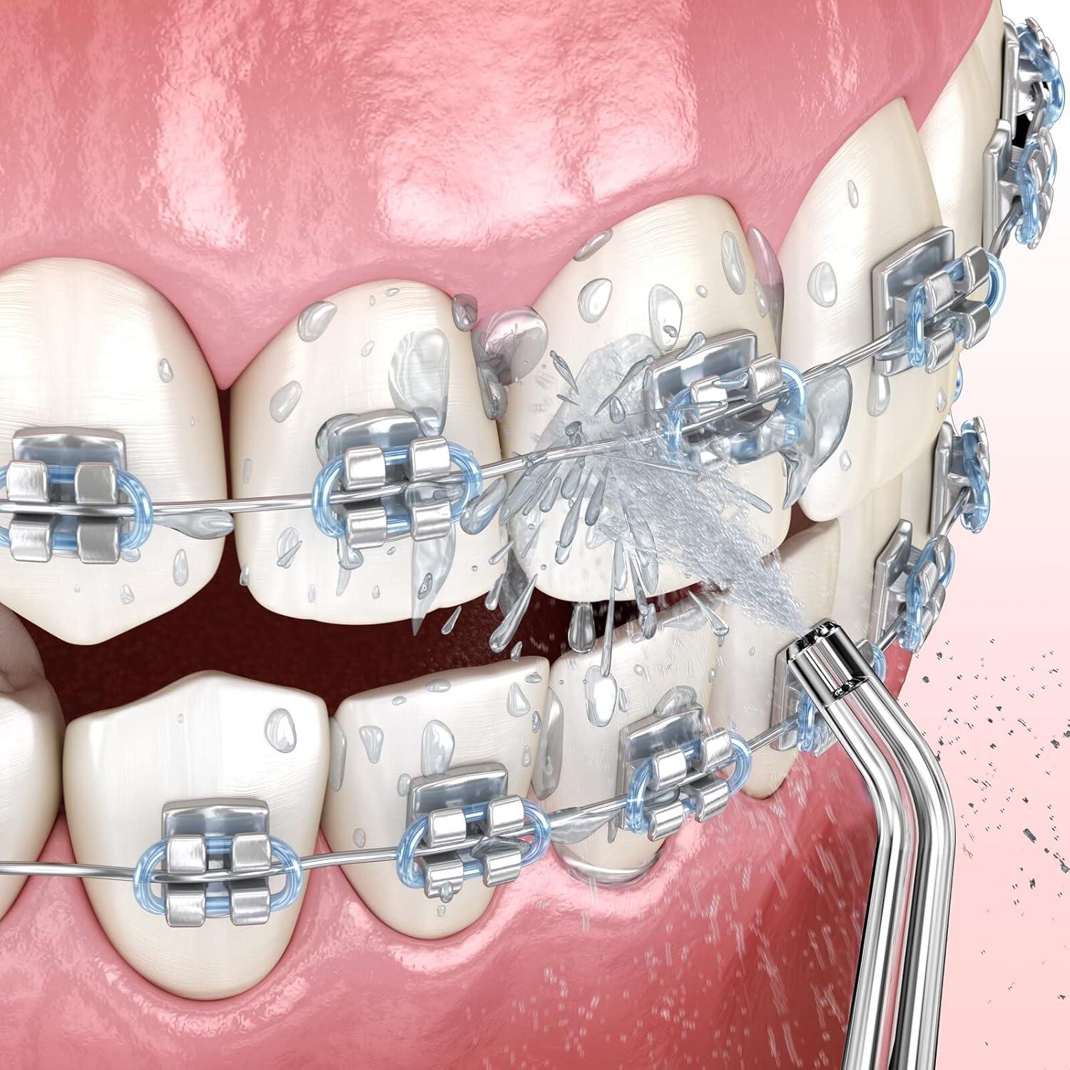 Consejos de Reemplazo ZACCER para Irrigador Bucal 8 Piezas