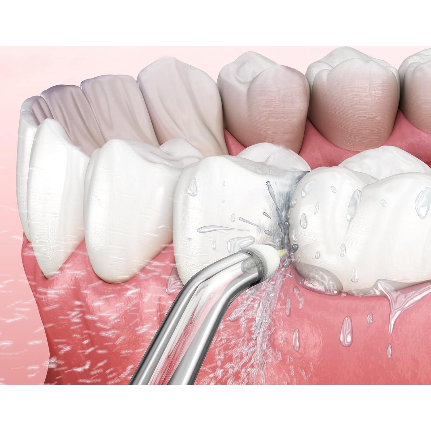 Consejos de Reemplazo ZACCER para Irrigador Bucal 8 Piezas
