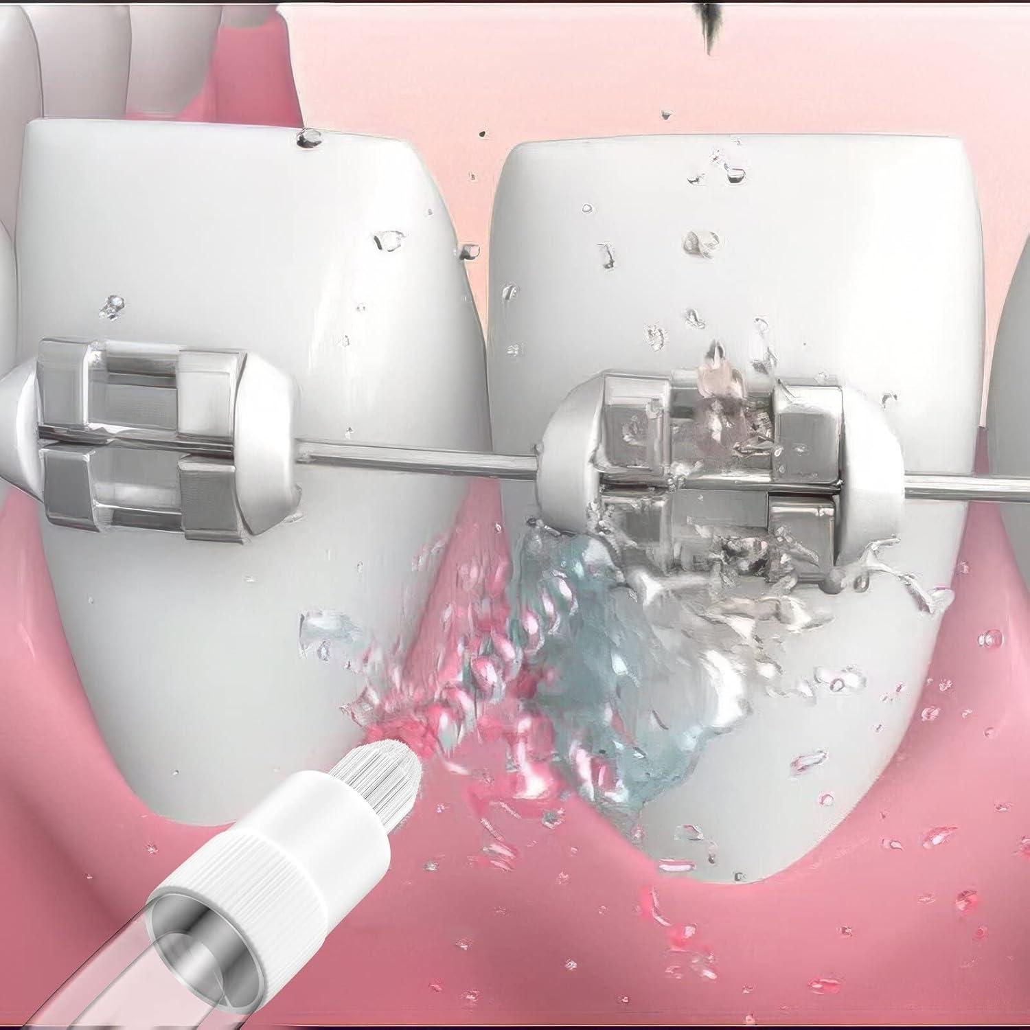 Consejos de Reemplazo ZACCER para Irrigador Bucal 8 Piezas
