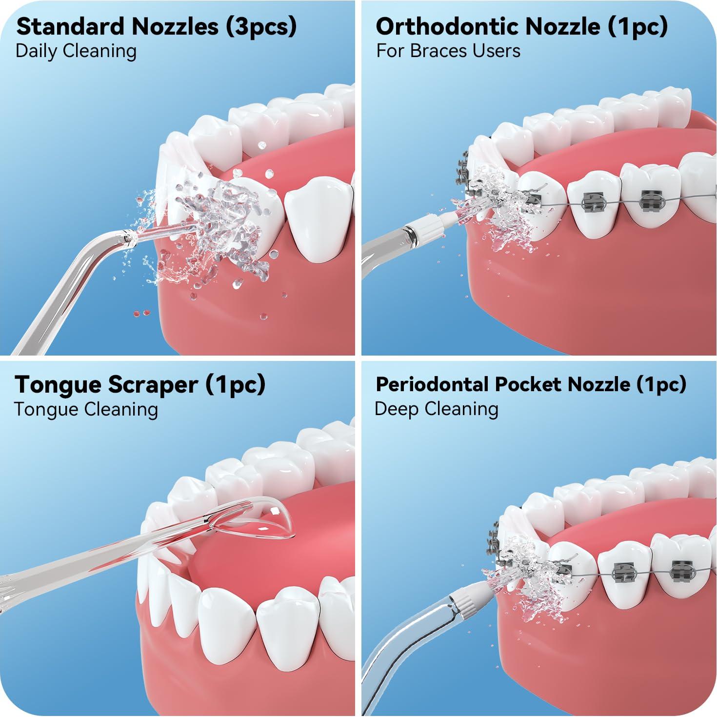 Puntas de Reemplazo para Irrigador Dental JTF F200 F300 - 6 Unidades