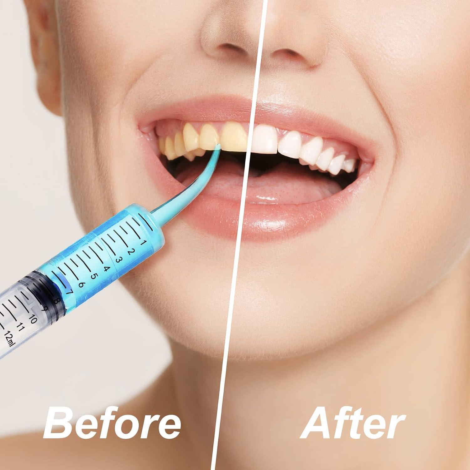 Jeringa Dental Zhengmy Pack 100 Piezas 12ml Punta Curvada