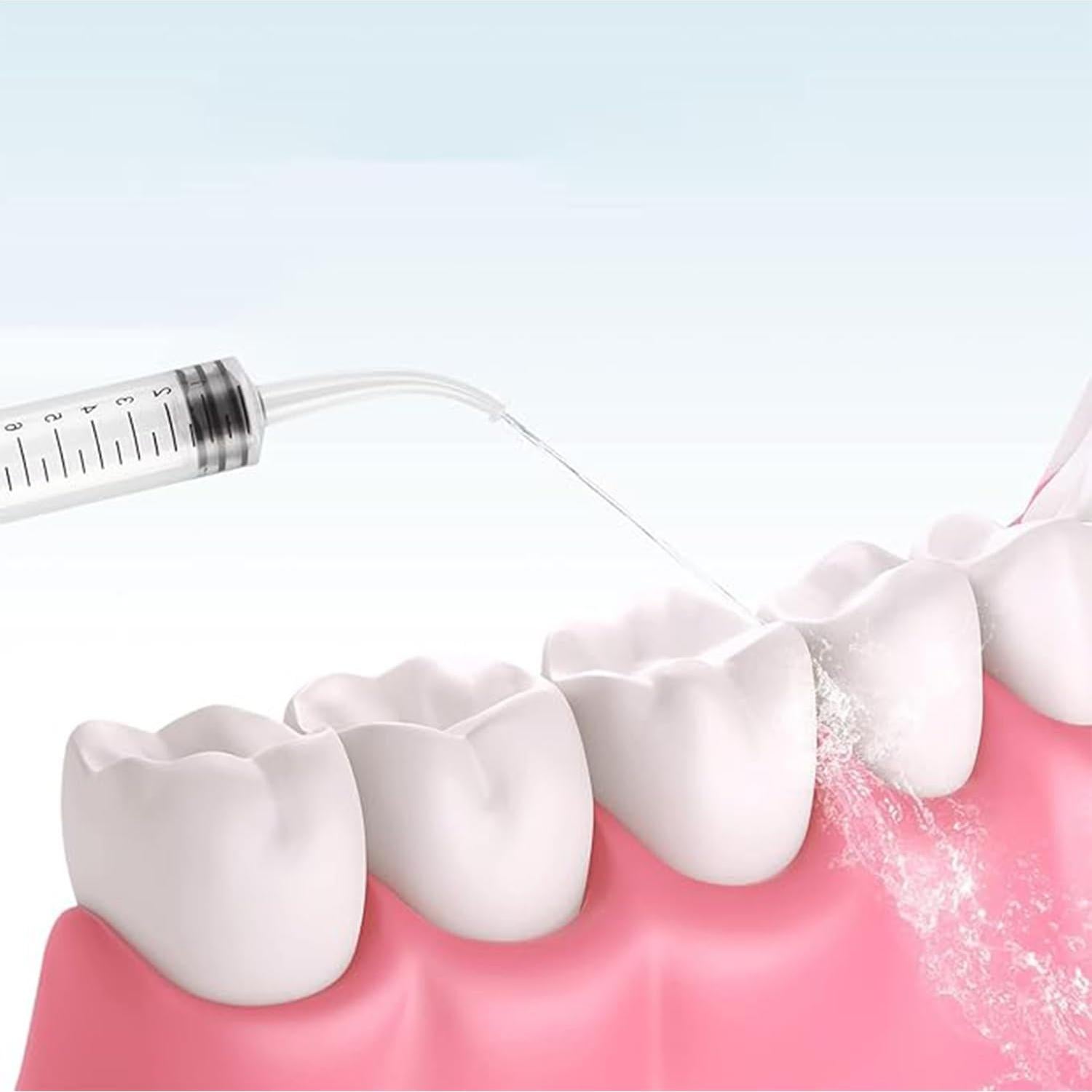 Jeringas Dentales Curvadas 12ml Xfanmlan - Paquete de 12