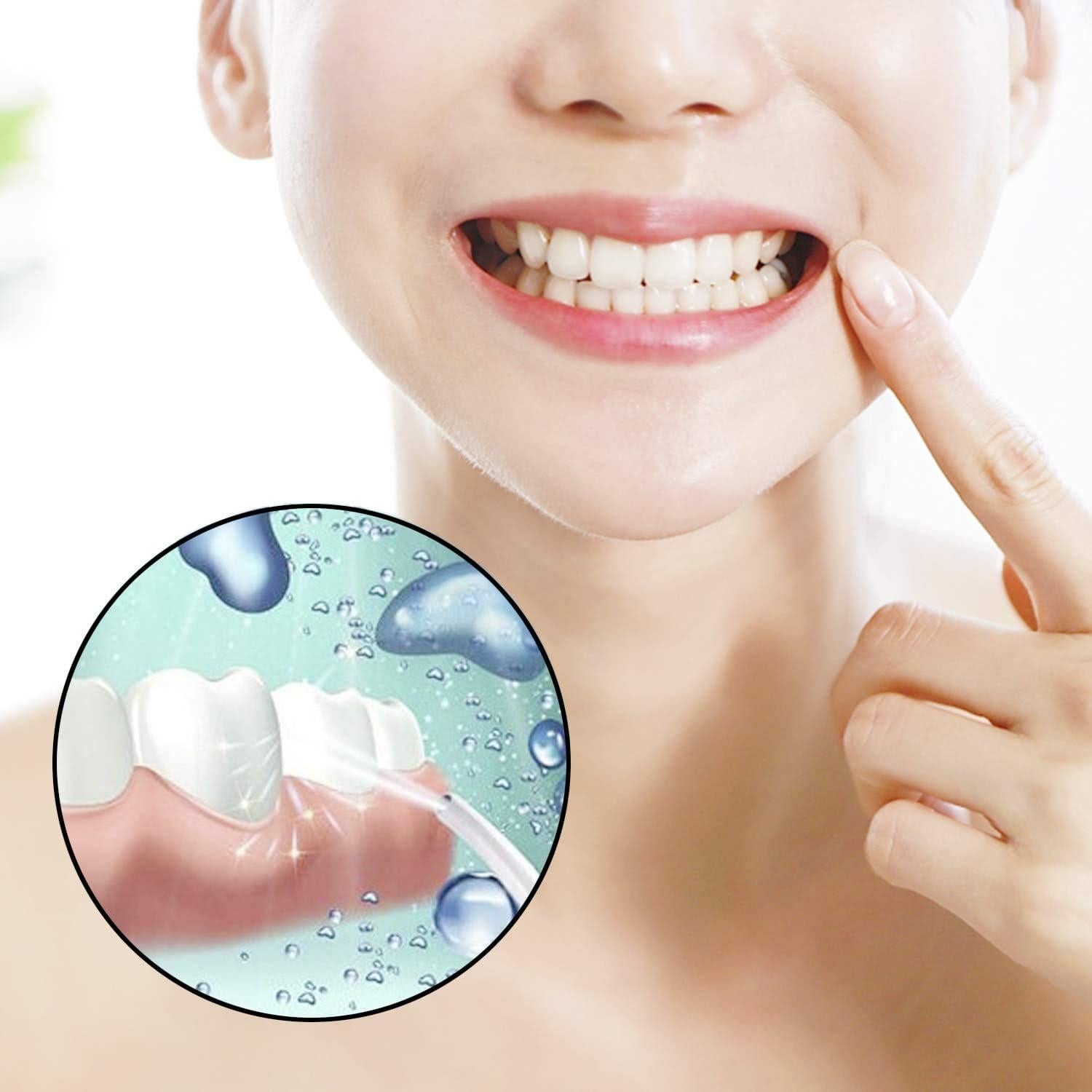 Benvo Paquete de 6 Jeringas Dentales Desechables 12ml Punta Curvada